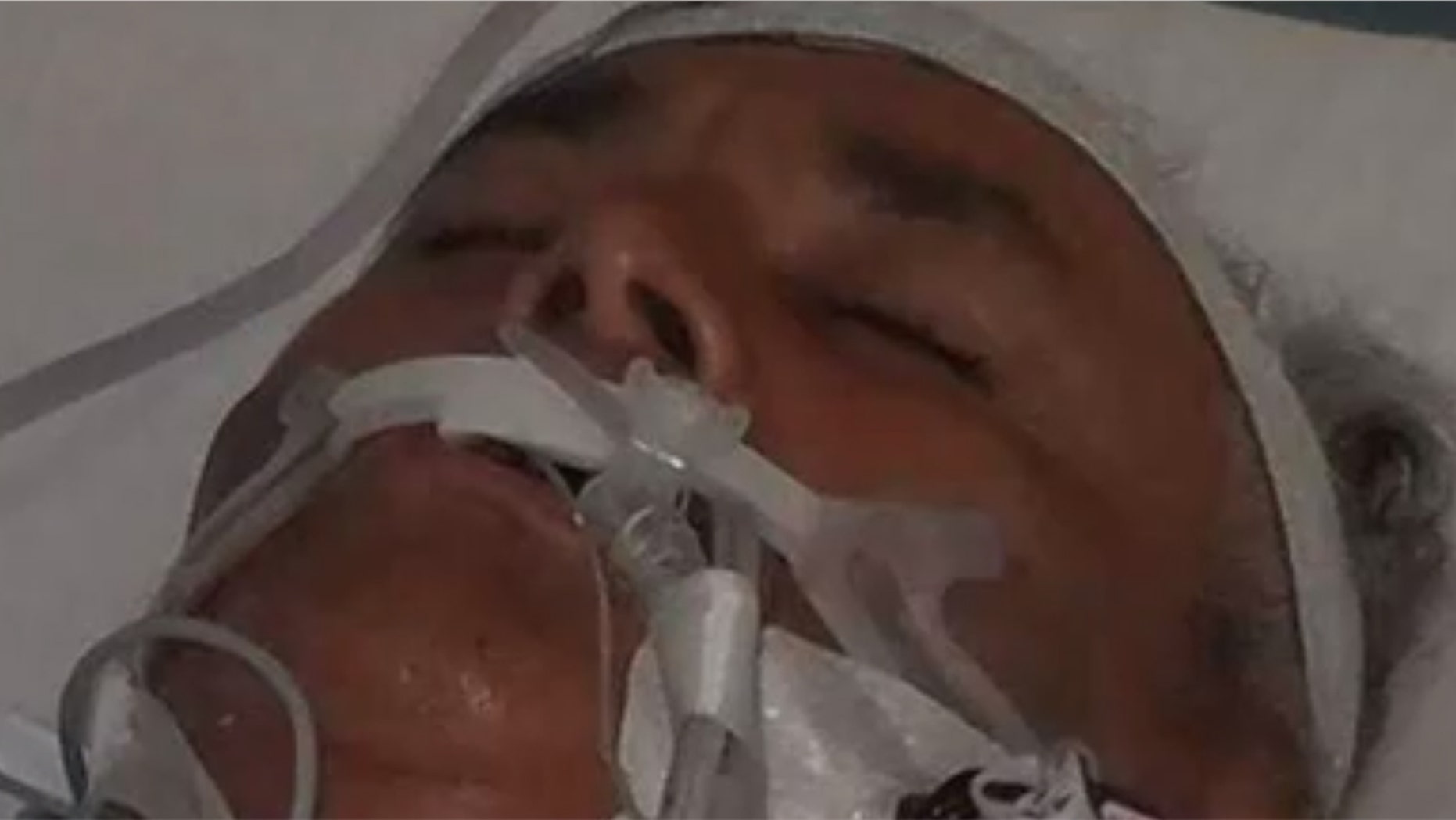 Angel Perez, 60, complained of symptoms after returning from crabbing on July 2.