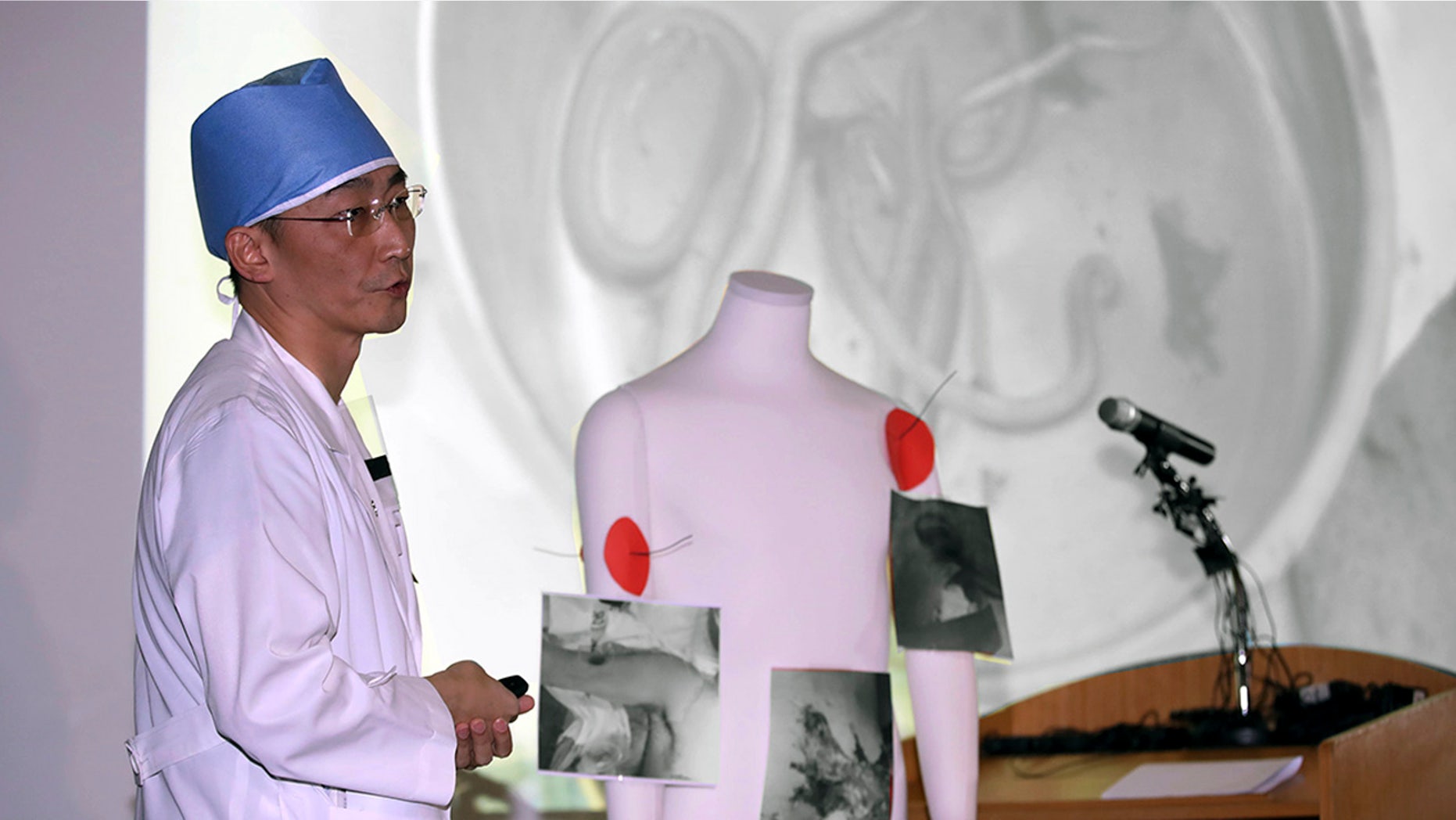 Surgeon Lee Cook-jong said he had 'not found parasites this big in the intestines of South Koreans.