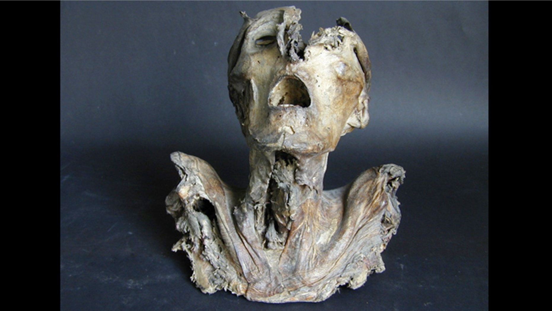 This anatomical specimen dating to the 1200s is the oldest known in Europe.