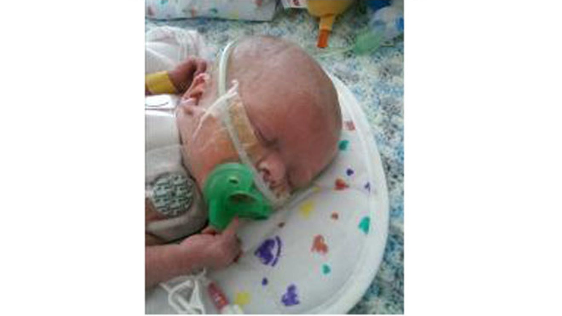 Oliver Hope received a heart transplant when he was just 6 days old.