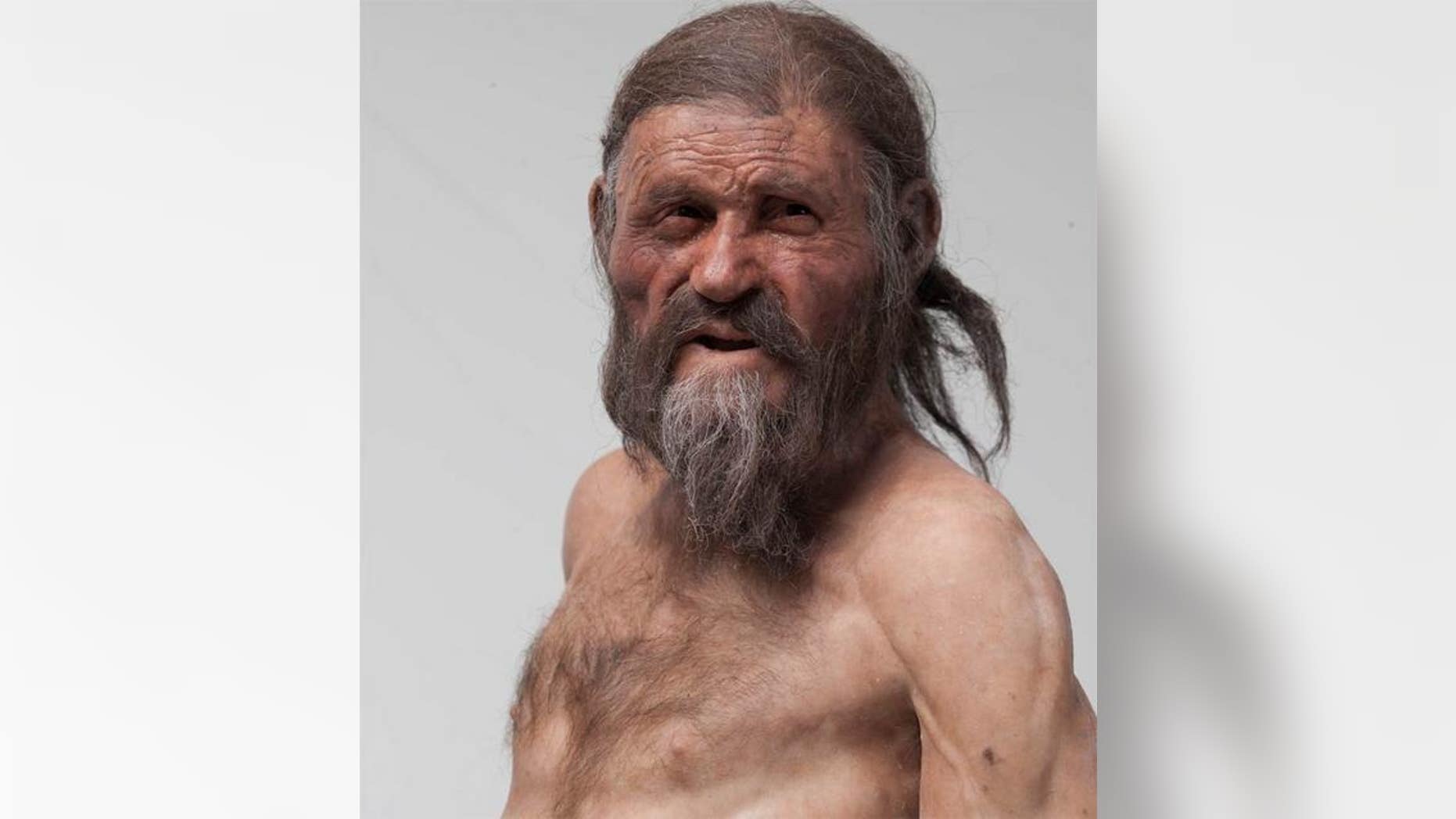 Ötzi the Iceman, a well-preserved mummy discovered in the alps in 1991, showed evidence of calcium buildup in his arteries. Now, new research shows he had a genetic predisposition to heart disease.