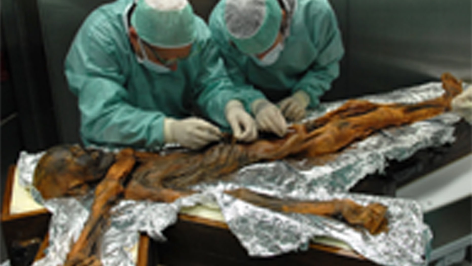 Scientists take samples from Ötzi's stomach during an exam in Bolzano, Italy, in November 2010. Credit: South Tyrol Museum of ArchaeologyEuracM. Samadelli