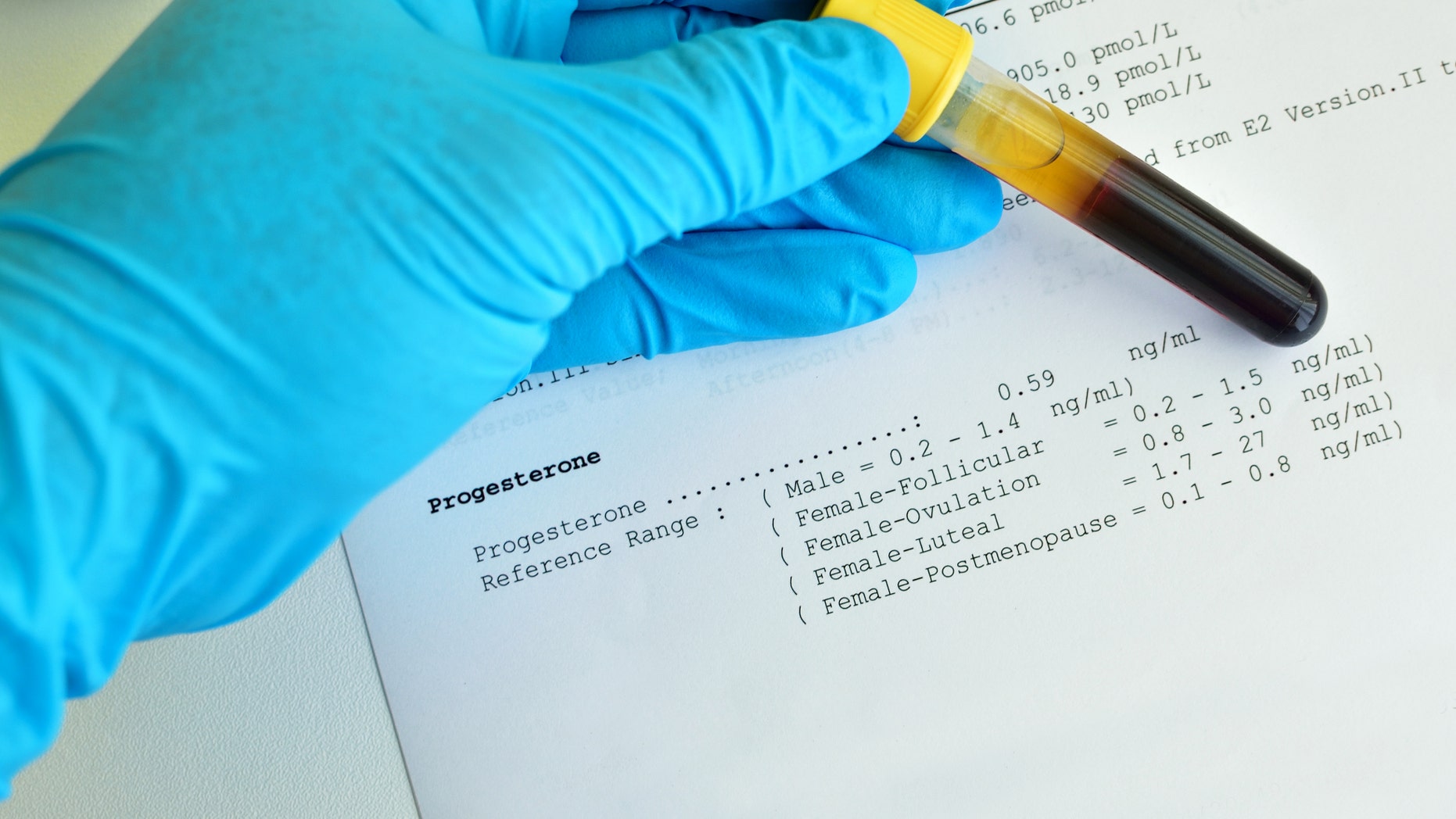 Blood sample with progesterone testing result