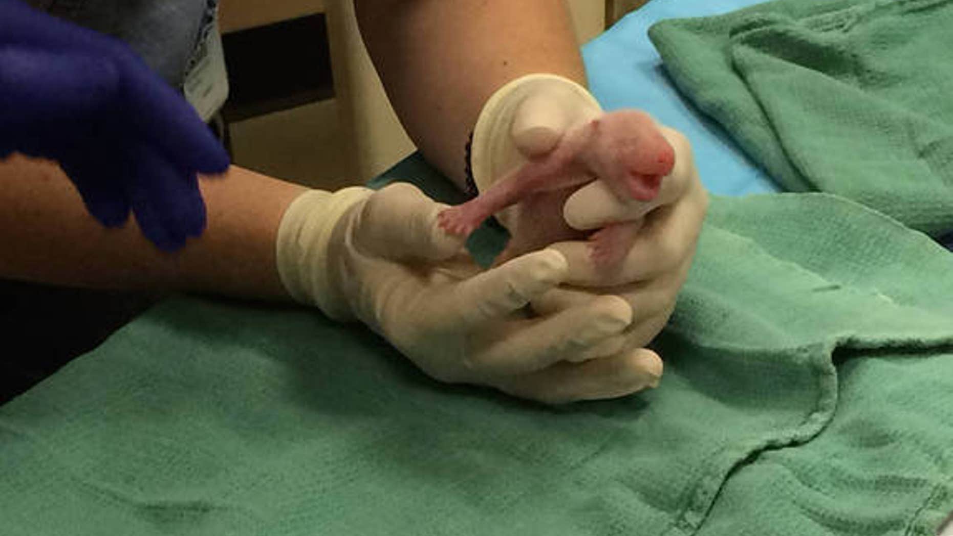 One of Mei Xiang's twin panda cubs died on Aug. 26, 2015 (shown here), just five days after it was born. Mei Xiang and her other panda cub are healthy, zoo officials say.