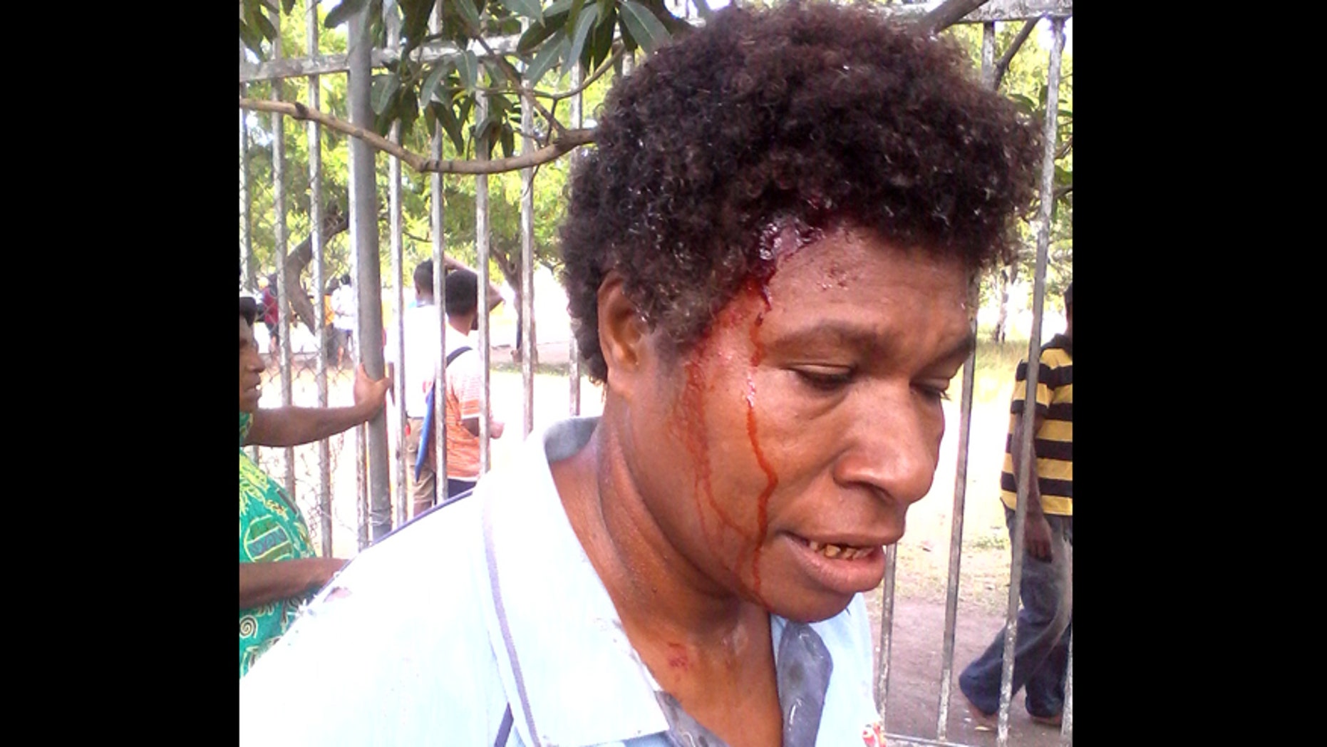 June 8, 2016: In this photo provided by Staycey Yalo, 34-year-old Esther Was bleeds from a head wound suffered during a student protest in Port Moresby, Papua New Guinea.