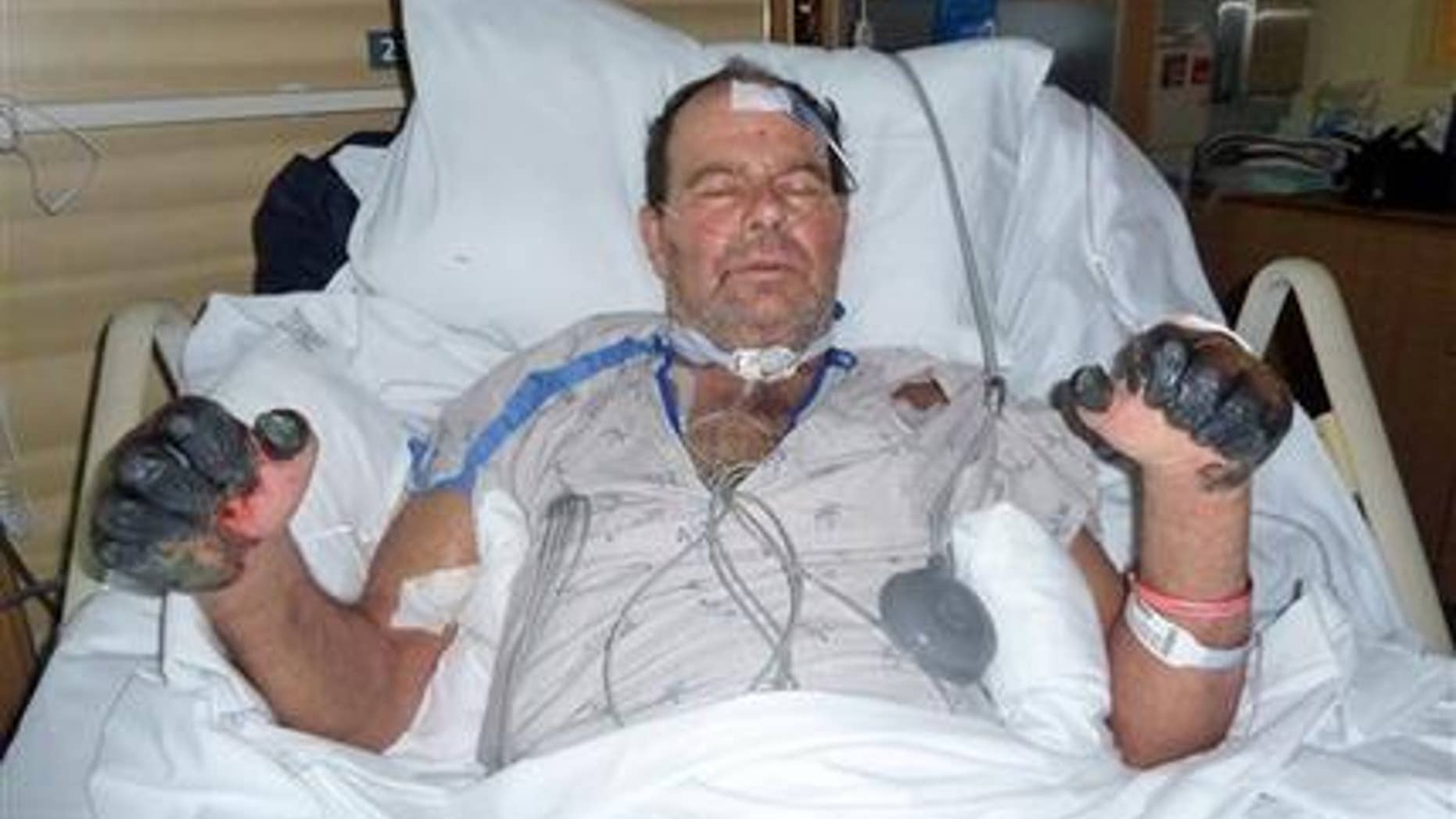 This photo supplied by the Gaylord family taken July 6, 2012, at a hospital in Bend, Ore., shows Paul Gaylord as he recovers from the plague. (AP Photo/The Gaylord Family, ho)