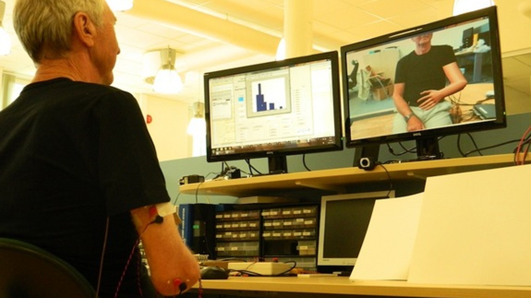 In the augmented reality environment, the patient can see himself with a superimposed virtual arm, which is controlled by muscle signals from his arm stump.