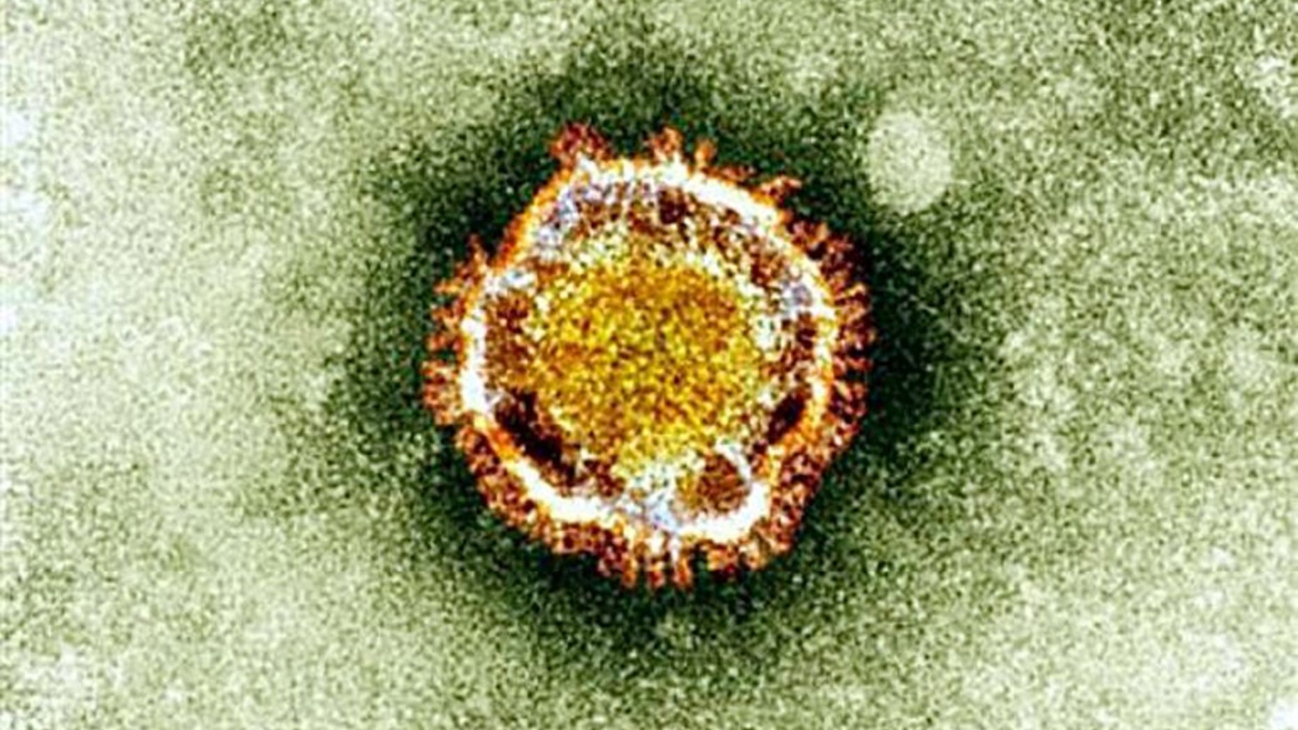 This undated handout picture courtesy of the British Health Protection Agency shows the Coronavirus seen under an electron miscroscope. Health authorities in the UAE have announced that an 82-year-old man has been diagnosed with the MERS coronavirus infection, the first case to be recorded in the Gulf state.