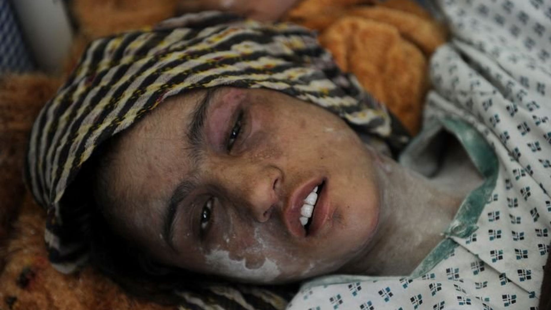Afghan child bride Sahar Gul, 15, lies in a bed as she recovers at the Wazir Akbar Khan hospital in Kabul, on January 12, 2012. A court in Kabul has ordered the early release of three people convicted over the torture of Sahar, in a move denounced by activists as a blow for women's rights.