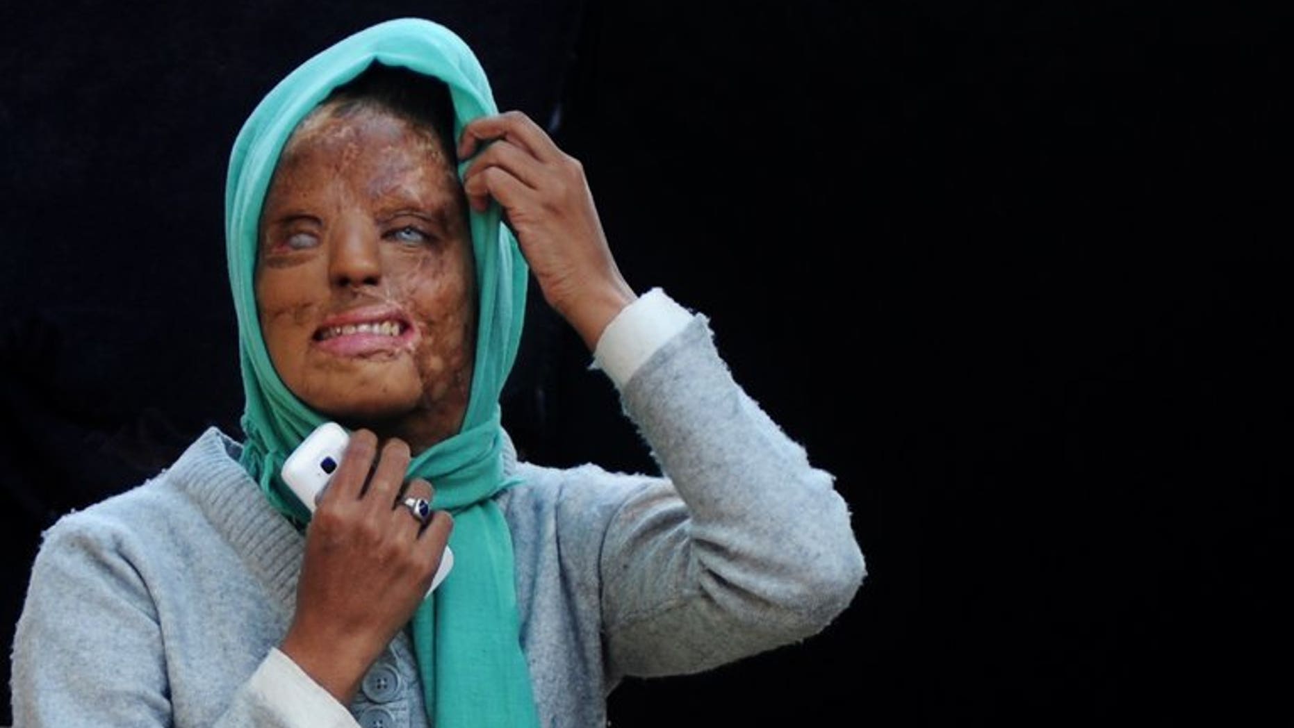In a picture taken on December 6, 2012, acid attack survivor Sonali Mukherjee poses outside her temporary home in New Delhi. India's top court ruled Thursday that authorities must regulate the sale of acid used in a spate of attacks on women by jilted boyfriends and others.