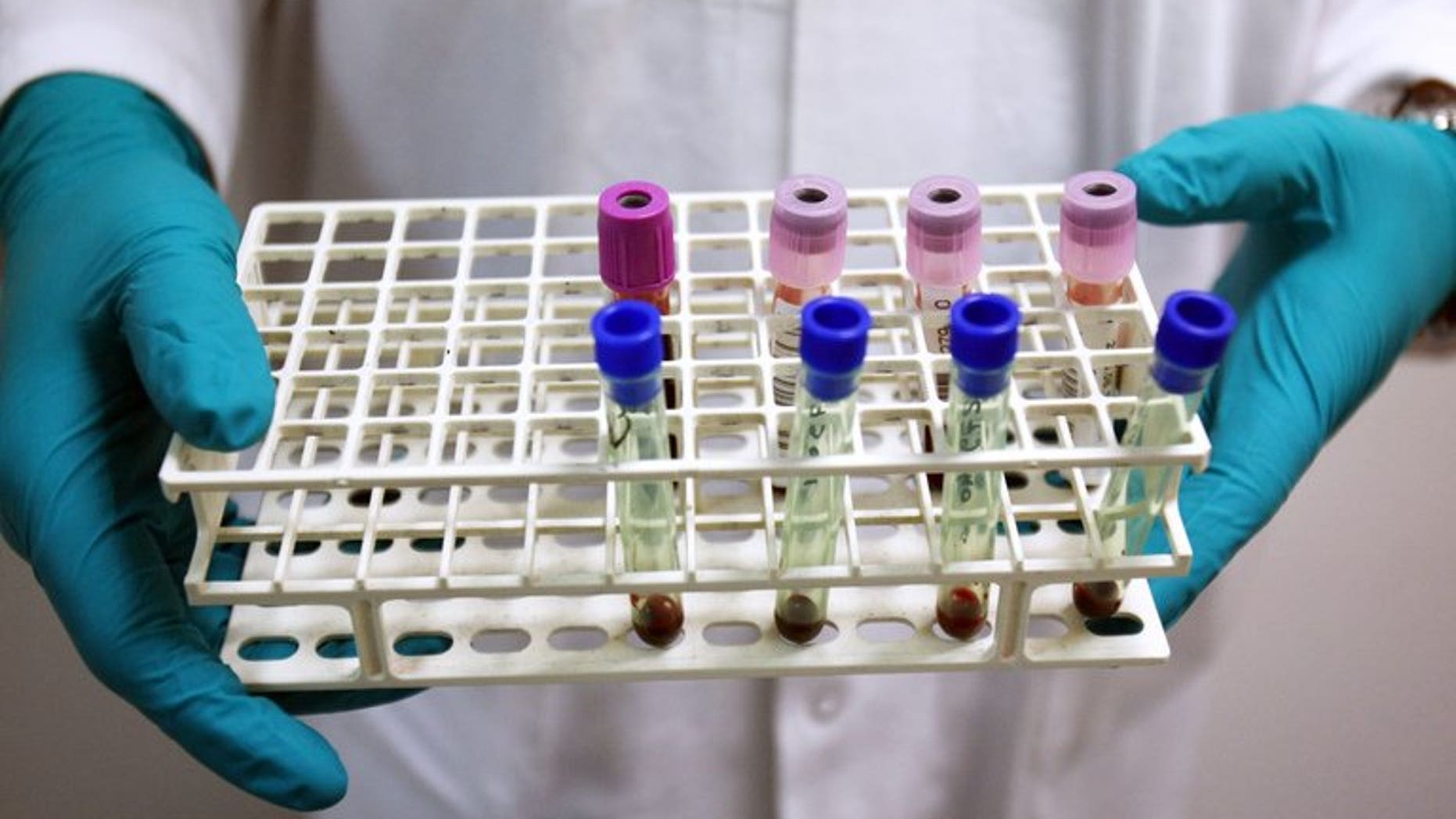 This file illustration photo shows a technician holding blood samples a laboratory near Paris. A Singapore-based group fighting the spread of viral hepatitis called for greater political will to combat the disease, as new data showed it killed one person every 30 seconds in Asia.