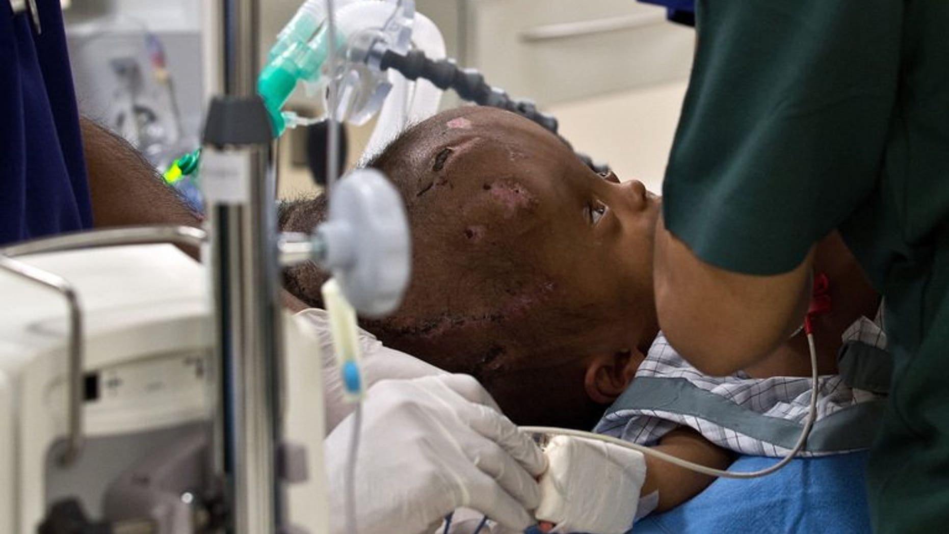 Doctors prepare 1-year old Roona Begum, suffering from hydrocephalus, a buildup of fluid inside the skull that leads to swelling, for surgery at a hospital in Gurgaon, on the outskirts of New Delhi, on June 27, 2013. The girld endured several surgical procedures which saw doctors drain fluid from her head in a life-saving operation and dramatically reduce the size of her skull.