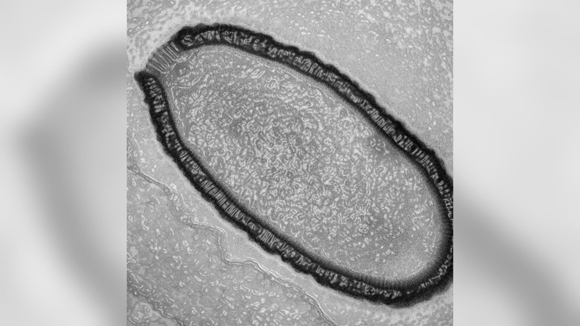 An ultrathin section of a Pithovirus particle in an infected Acanthamoeba castellanii cell observed by transmission electron microscopy with enhancement