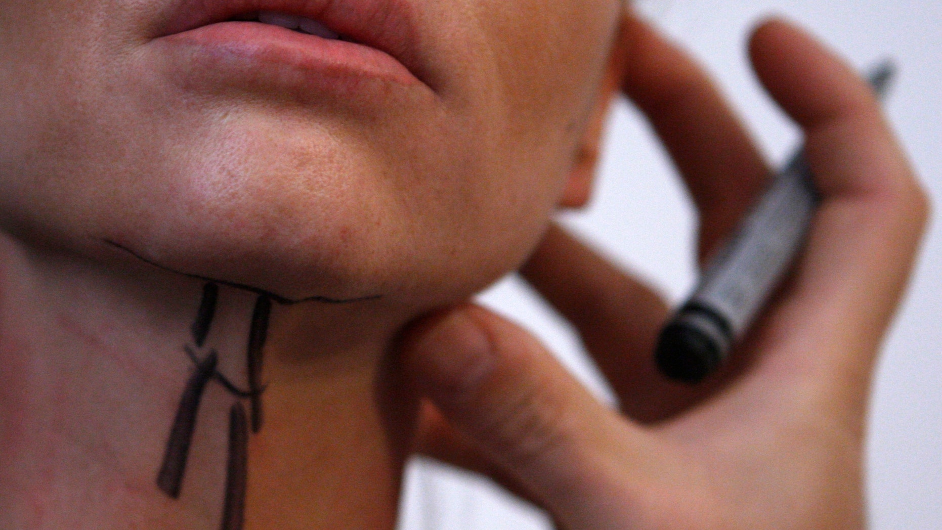 A patient prepared for a facelift surgery is seen at a private plastic surgery clinic in Budapest, March 1, 2012.