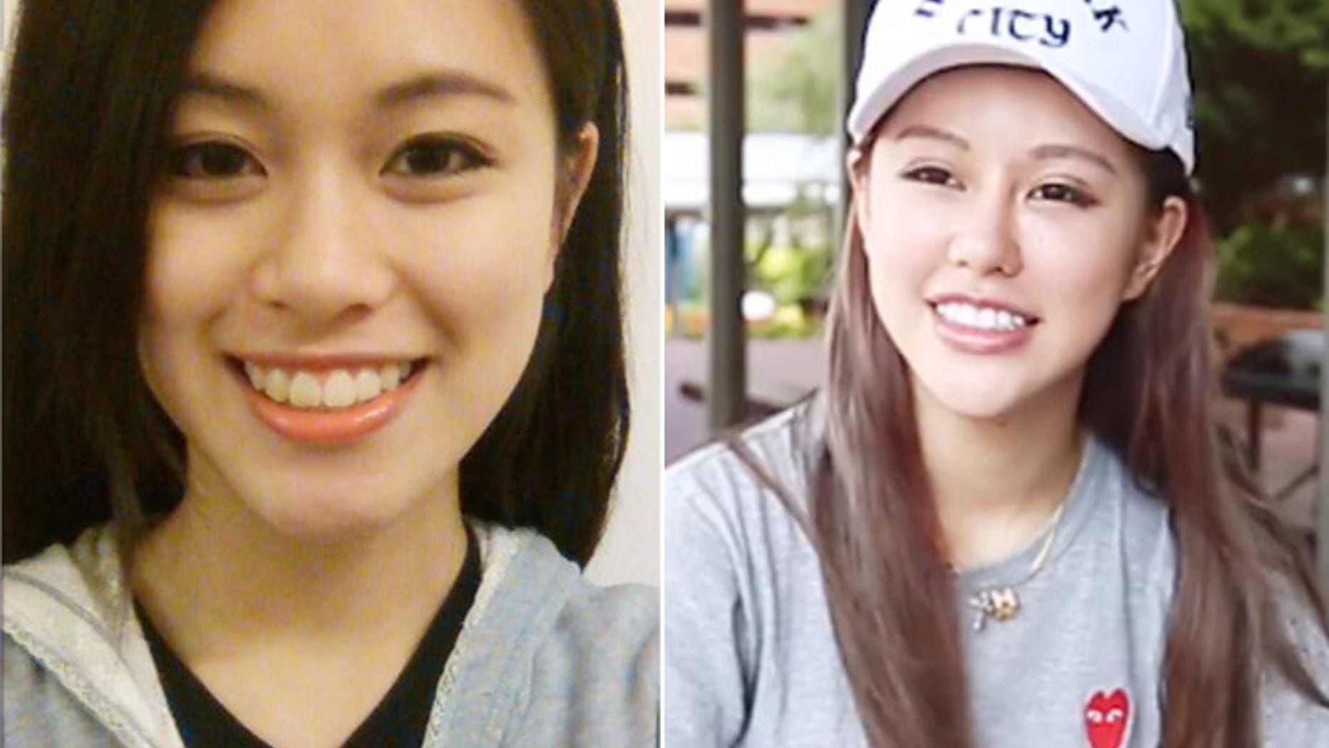 A 22-year-old woman regrets having gone under the knife so many times to please her boyfriend.