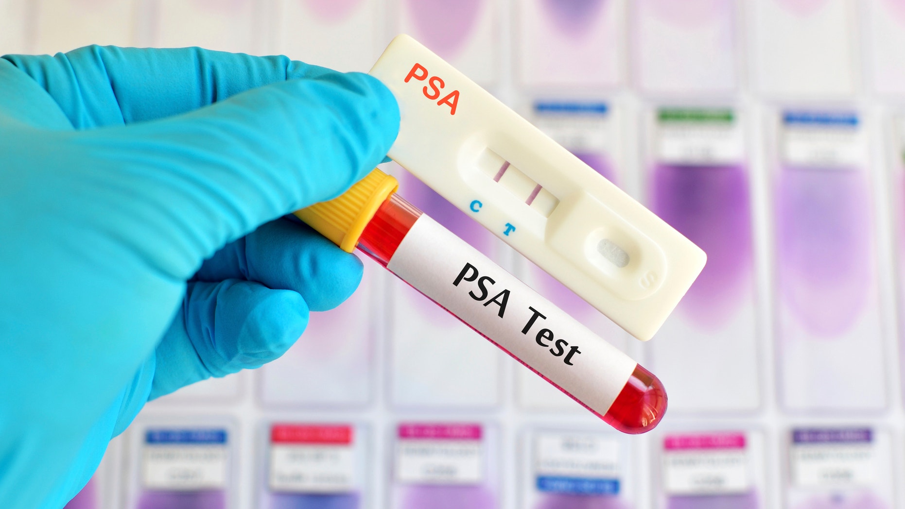 Prostate Cancer Tests Are Now OK With Panel With Caveats Fox News   Psa Test Prostate Cancer Istock Large 