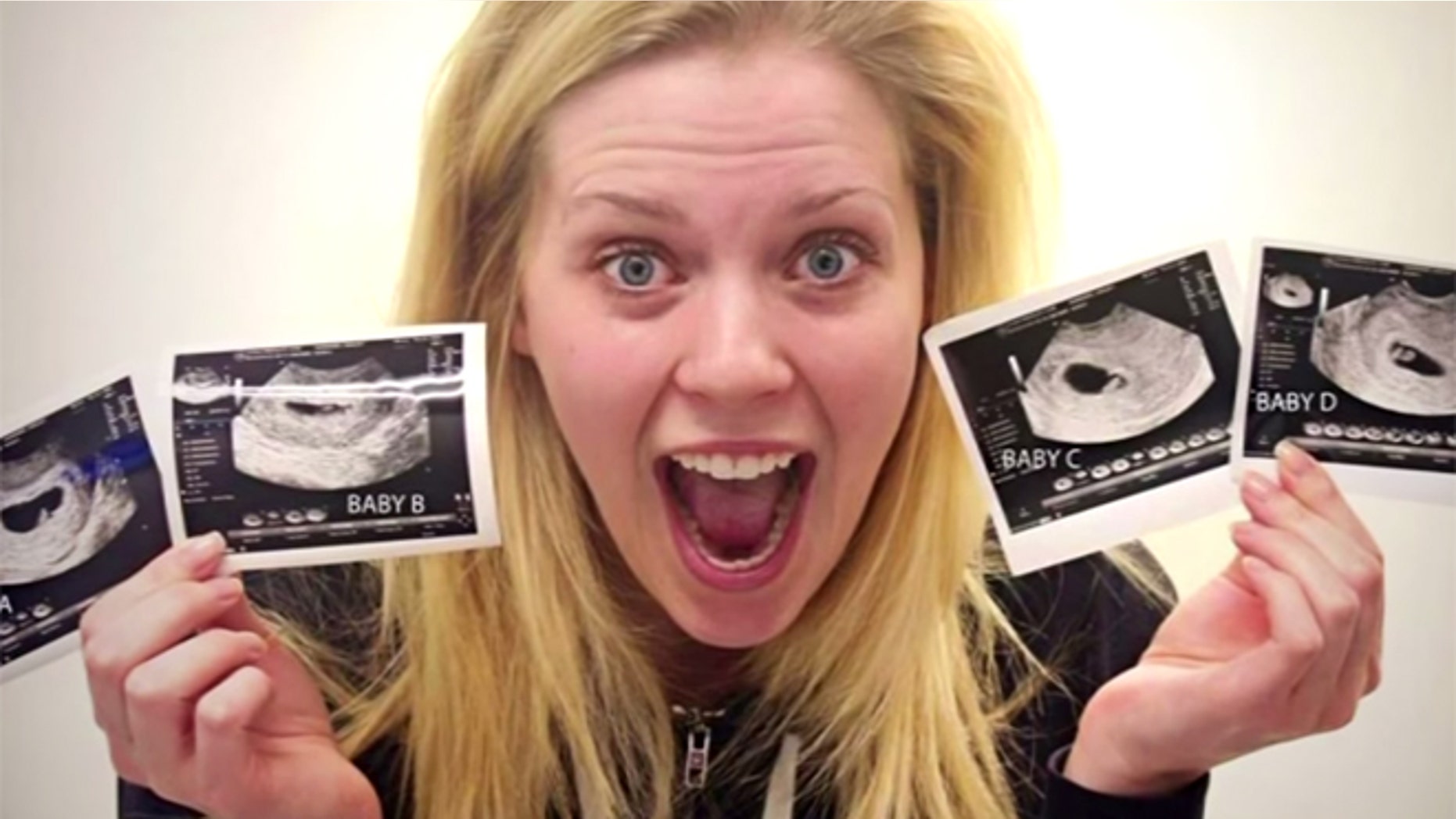 A shocked and ecstatic Ashley Garnder holds up four sonogram photos showing her four babies.