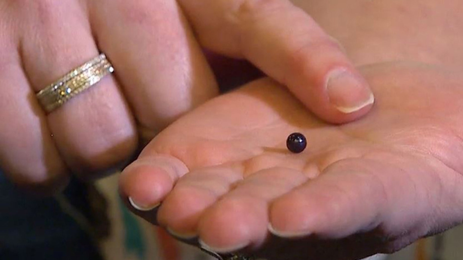 In this undated image taken from video provided by KOMOnews.com, Lindsay Hasz holds a rare pearl that she found in her seafood meal while dining at an Italian restaurant in Issaquah, Wash. Hasz said she took it to a gemologist, who determined it was a Quahog purple pearl worth about $600. (KOMOnews.com via AP) SEATTLE OUT; NO SALES