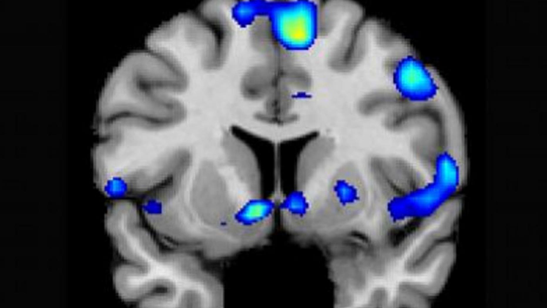 An image of brain areas activated when an individual experiences spiritual feelings.