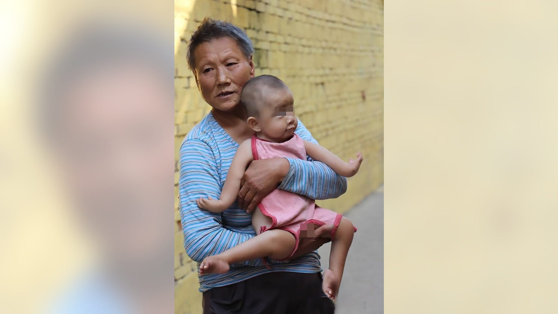 Pic shows: The boy Wang Sanjin and his grandmother Zhou Xuelian;
The grandmother of a boy born with his limbs facing the wrong way is hoping the public will help fund surgery that would give him a chance at a normal life.
The one-year-old boy named Wang Sanjin was abandoned by his own parents at birth because of the defects which have left his hands and legs reversed at their elbow and knee joints.
The condition was considered so bad that Sanjinâs dad, from Zhumadian City in Central Chinaâs Henan Province, said he wanted nothing to do with the boy and that he would rather have another child.
But Sanjinâs grandmother Zhou Xuelian could not bear to simply cast the child out, so she brought him back to her own home and raised her with her husband.
In the 15 months since Sanjinâs birth, his dad has not visited once or provided any form of financial support, while his mum is as a migrant worker in another city.
Zhou and her husband, who are in their 60s and 70s, make a living by collecting and selling recyclable waste, and they are hoping to crowd-fund Sanjinâs treatment so he can potentially live a normal and independent life in the future.
Doctors have told Zhou that surgery to correct Sanjinâs bones would cost more than 300,000 RMB (34,642 GBP) â an amount she called "astronomical".
But with so many touching stories of crowdfunded medical miracles, the woman is hoping one can be performed on her grandson as well.
She was quoted as saying: "My husband and I are getting on now. Sanjinâs granddad is in his 70s and Iâm in my 60s. Who knows how long we can keep raising him for?"
"I hope some kind people will agree to help our boy, just so his condition can be cured and he can start taking care of himself, then we can rest easy."