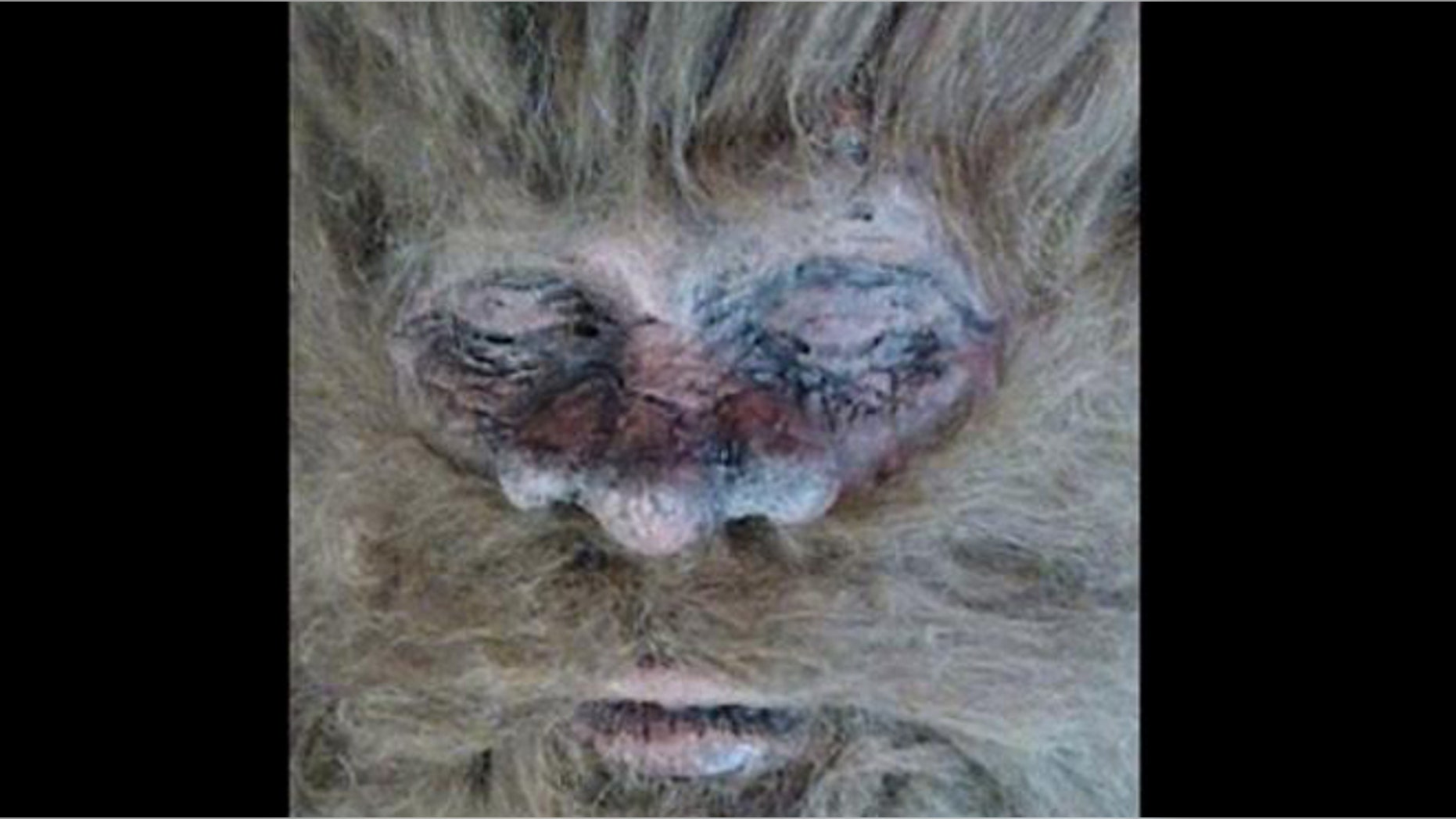 Bigfoot for real? This picture has been posted by an American hunter who claims to have killed the mythical beast.