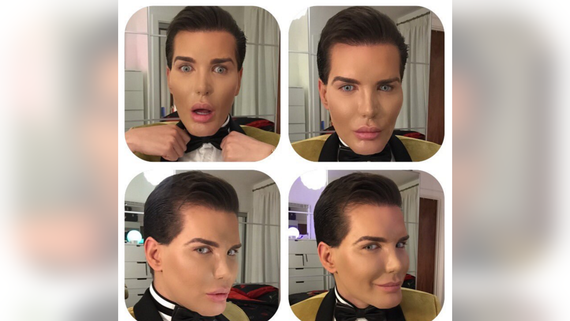 Mentally Ill Human Ken Doll Who Spent 400g On Plastic Surgery Suffering From Rotting Nose Fox News