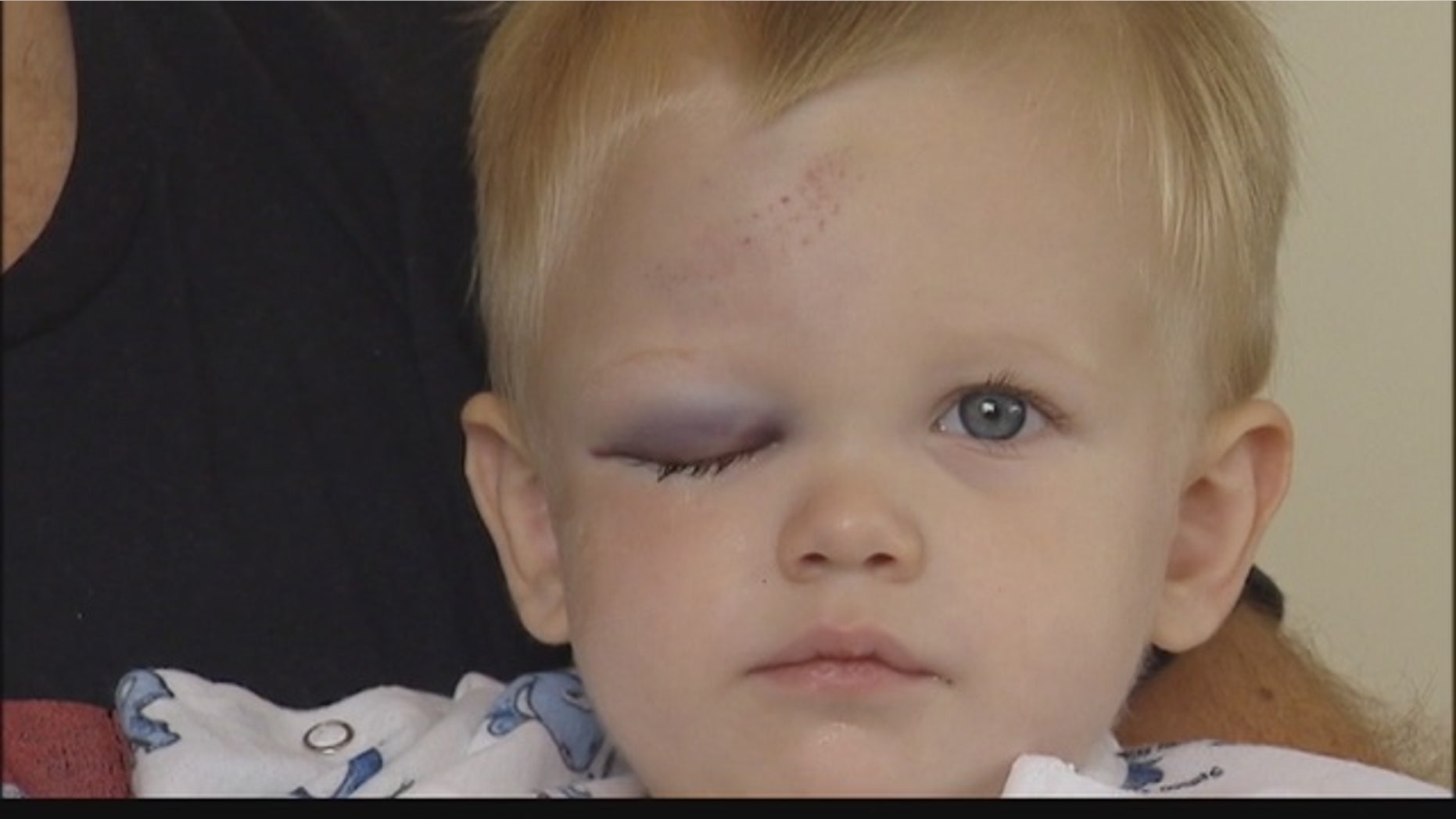 Rowan Senders is expected to make a full recovery after being hit by a home run ball at the Chicago White Sox game.