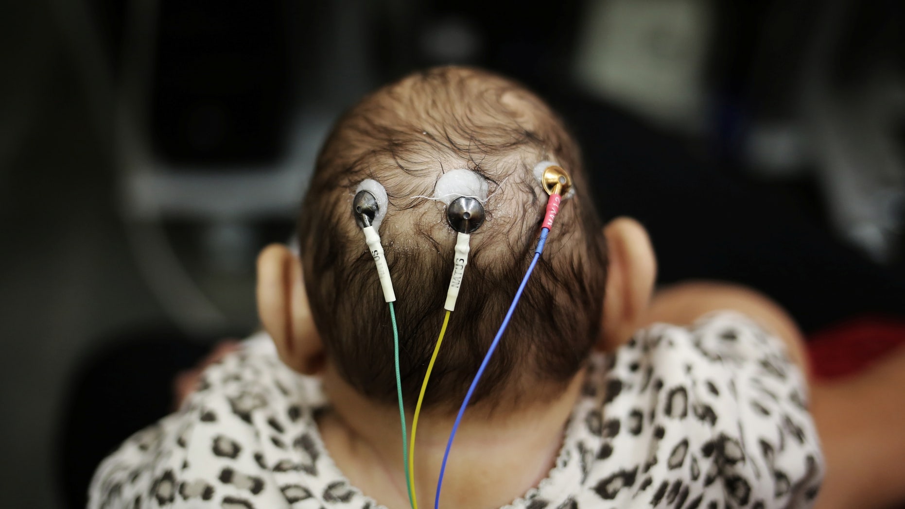 Five-month-old Laura undergoes a medical test at the University of Sao Paulo (USP) in Sao Paulo, Brazil April 28, 2016.