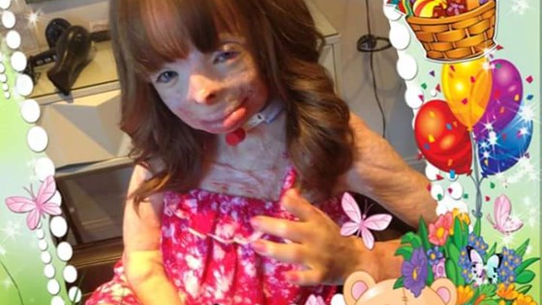 Safyre Terry suffered burns on more than 75 percent of her body in a fire that killed her siblings and father.