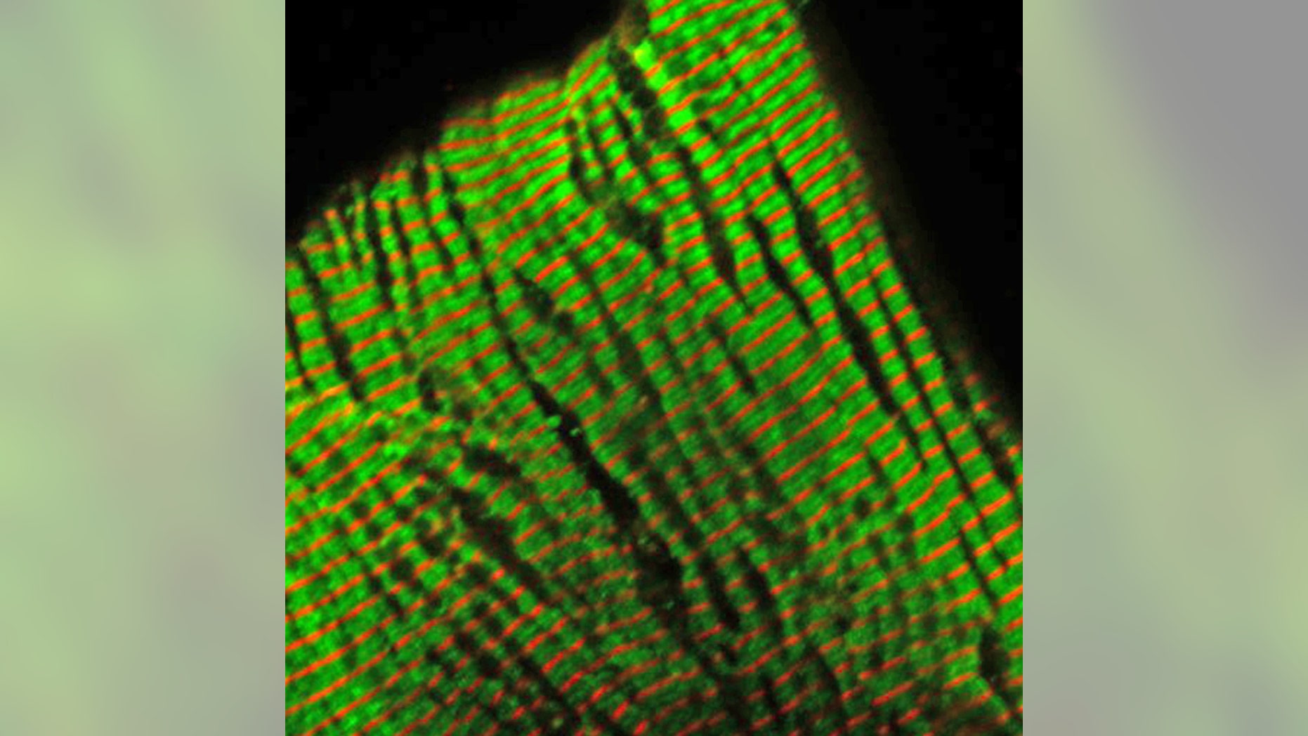 With cells illuminated by fluoresced antibodies, this microscopic photograph of sarcomeres— the part of heart muscle that generates tension and contraction— shows a mutant troponin protein used to study inherited cardiomyopathy.