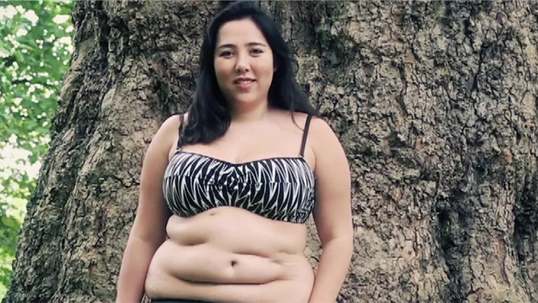 Michelle Elman, 21, created an inspirational video to help others shed the shame of their scars.