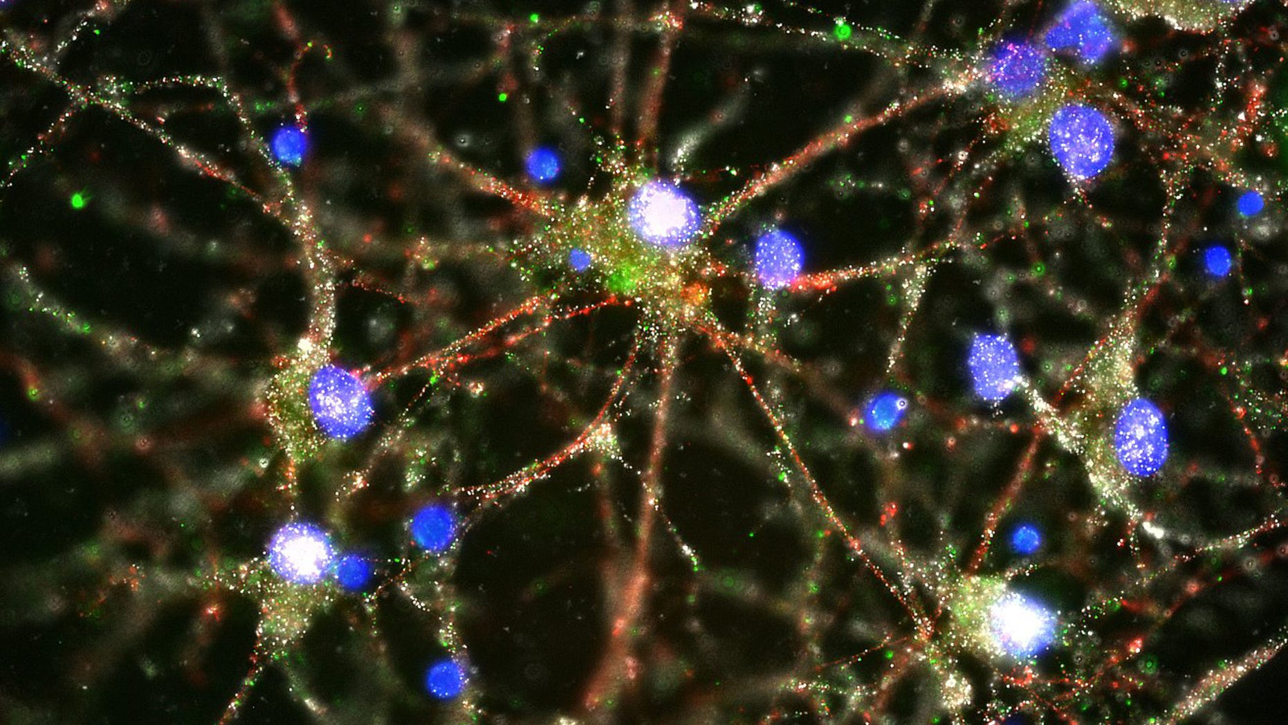 Jan. 27, 2016: Scientists pursuing the biological roots of schizophrenia have zeroed in on a potential factor -- a normal brain process that gets kicked into overdrive.