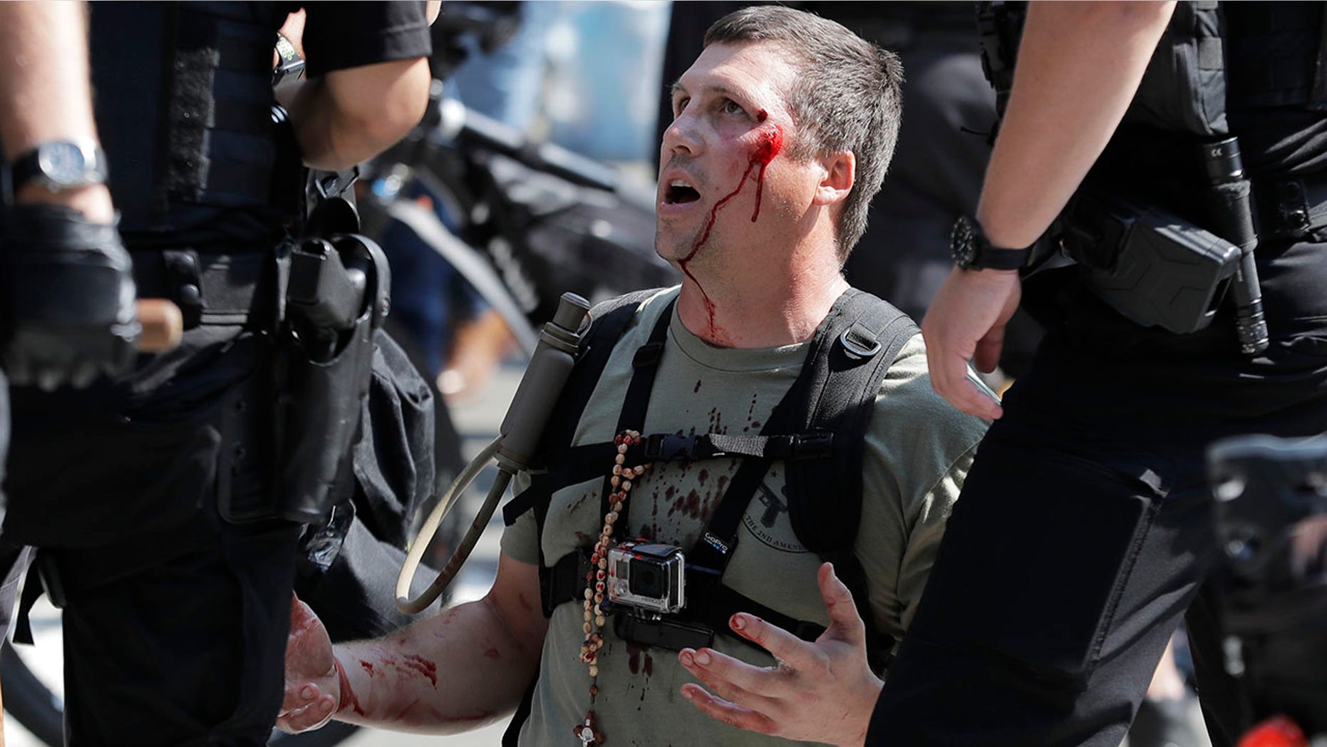 A man who was protesting with Patriot Prayer and other groups supporting gun rights is treated for an injury during a rally and counter-protest in Seattle, Aug. 18, 2018.