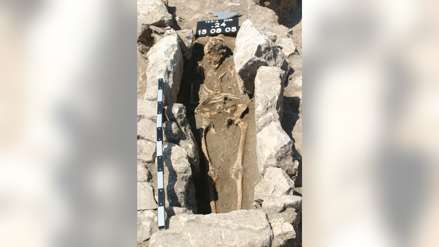 The skeleton of a woman who died 800 years ago on the outskirts of the ancient city of Troy in modern Turkey has yielded the first record of maternal sepsis in the fossil record.