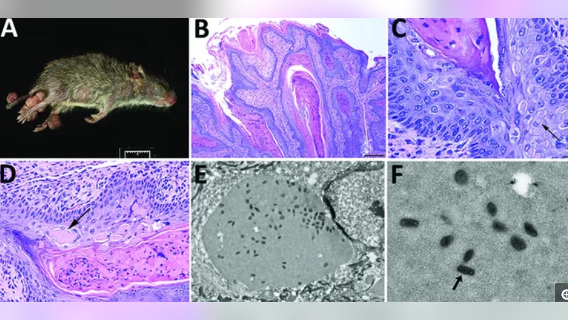 A newfound poxvirus, dubbed "Brazospox virus," was recently discovered in Texas rodents. Above, an image of an infected rodent with large skin lesions on its legs and tail (A); images of the skin lesions under a microscope, with arrows showing aggregates of viral proteins (B-D); images of the virus particles, which have a "brick-shape" appearance (E-F).