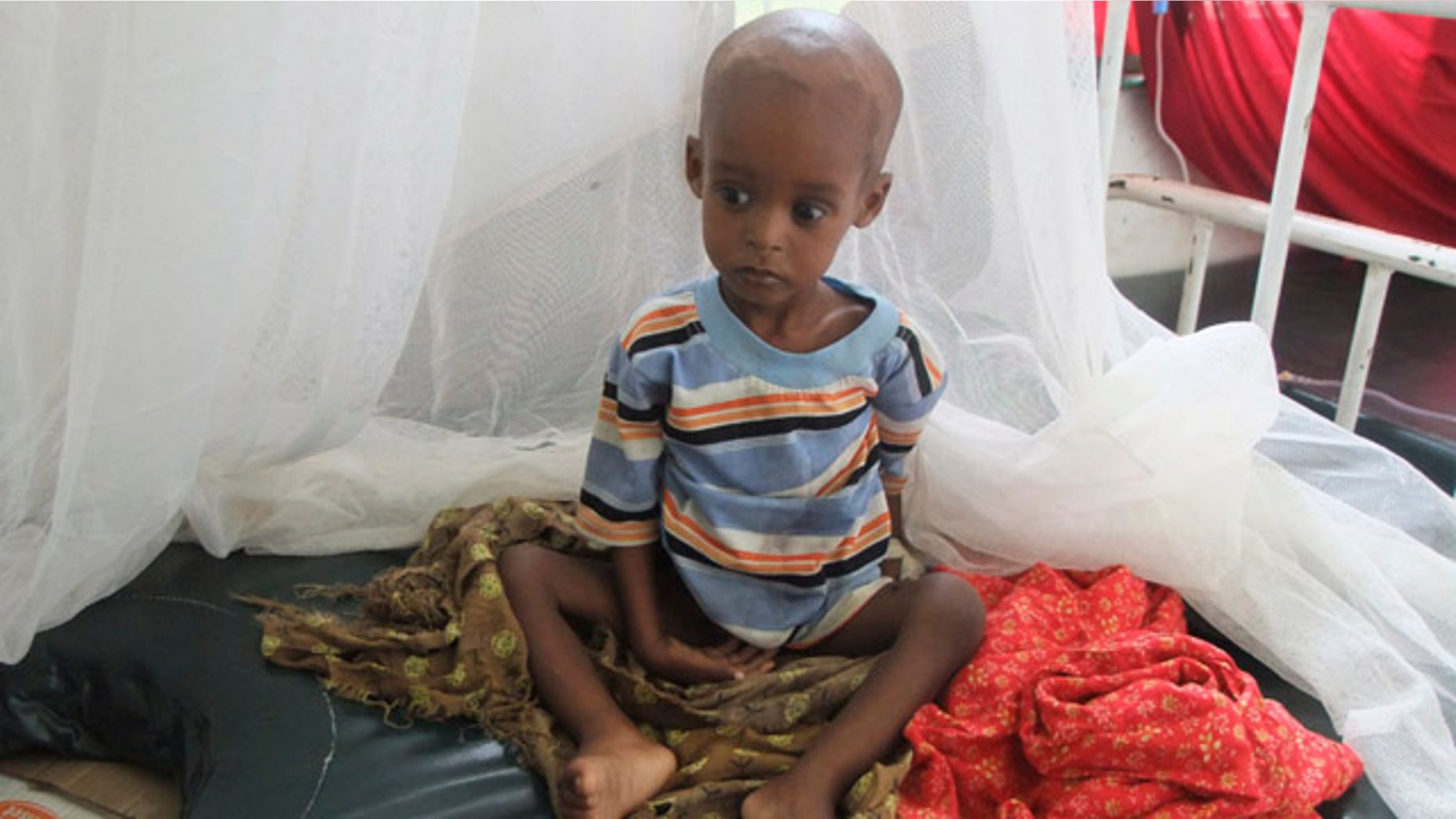 Aug. 1: A malnourished child from southern Somalia sits on a bed at Banadir hospital in Mogadishu.