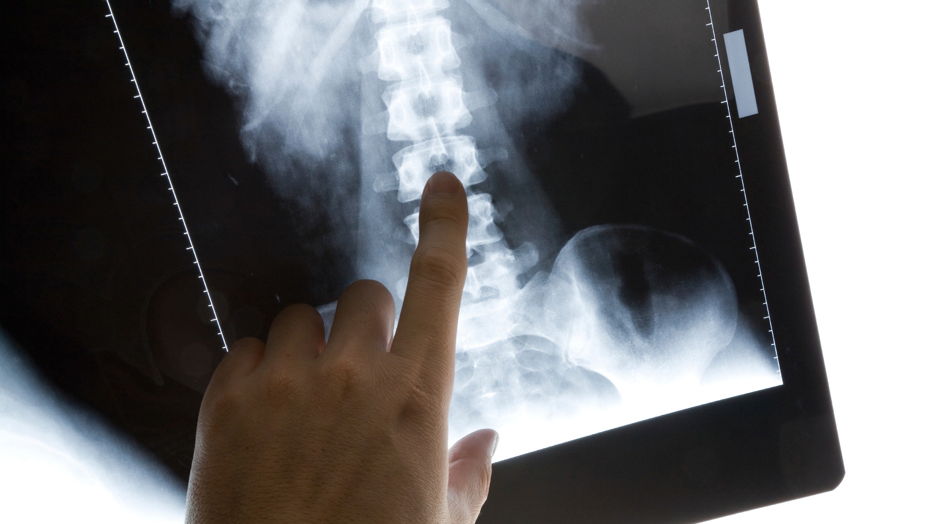 body x-ray photo for background