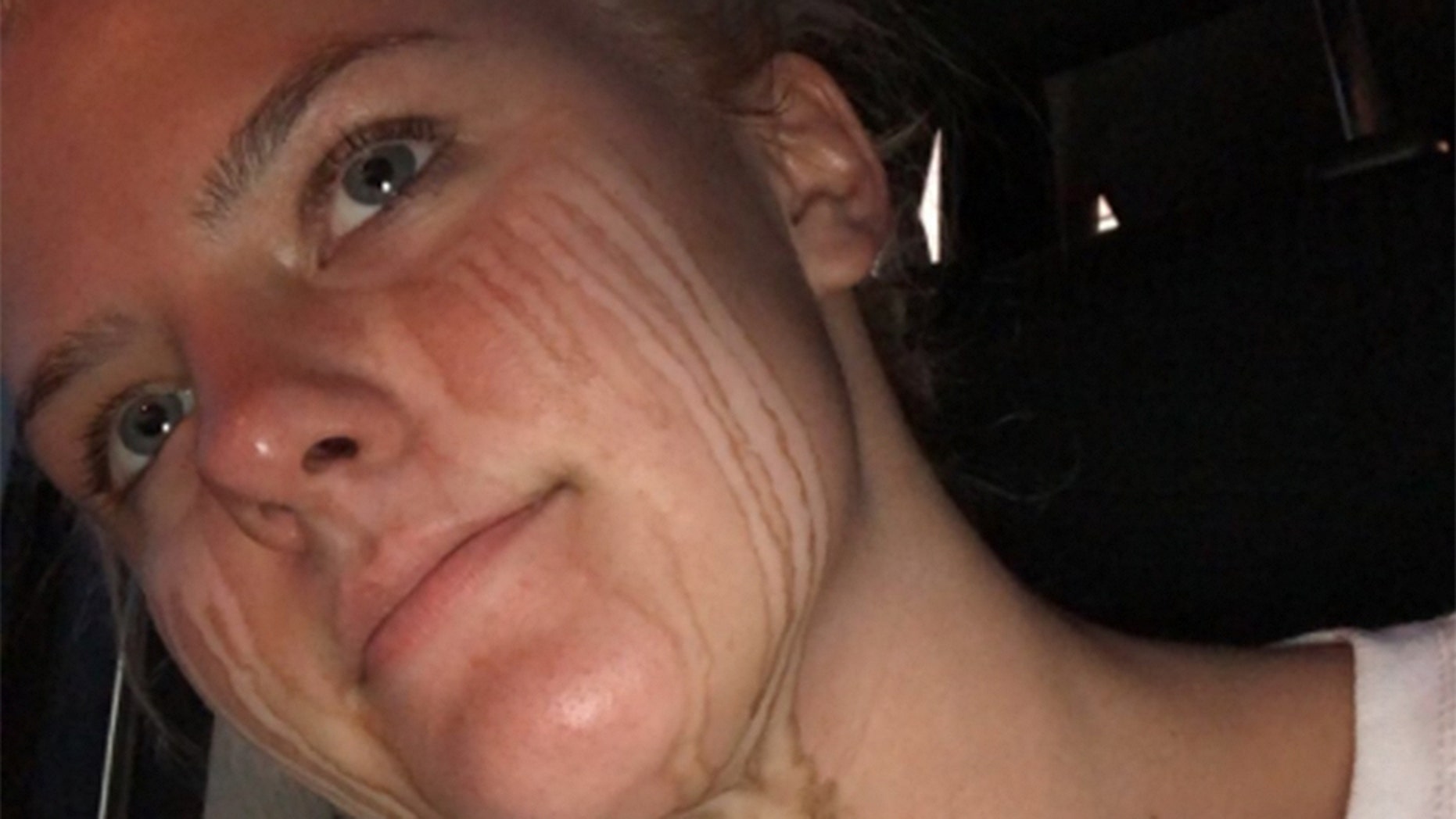 A 17-year-old high school student's spray tan fail is making the internet laugh -- and relate.
