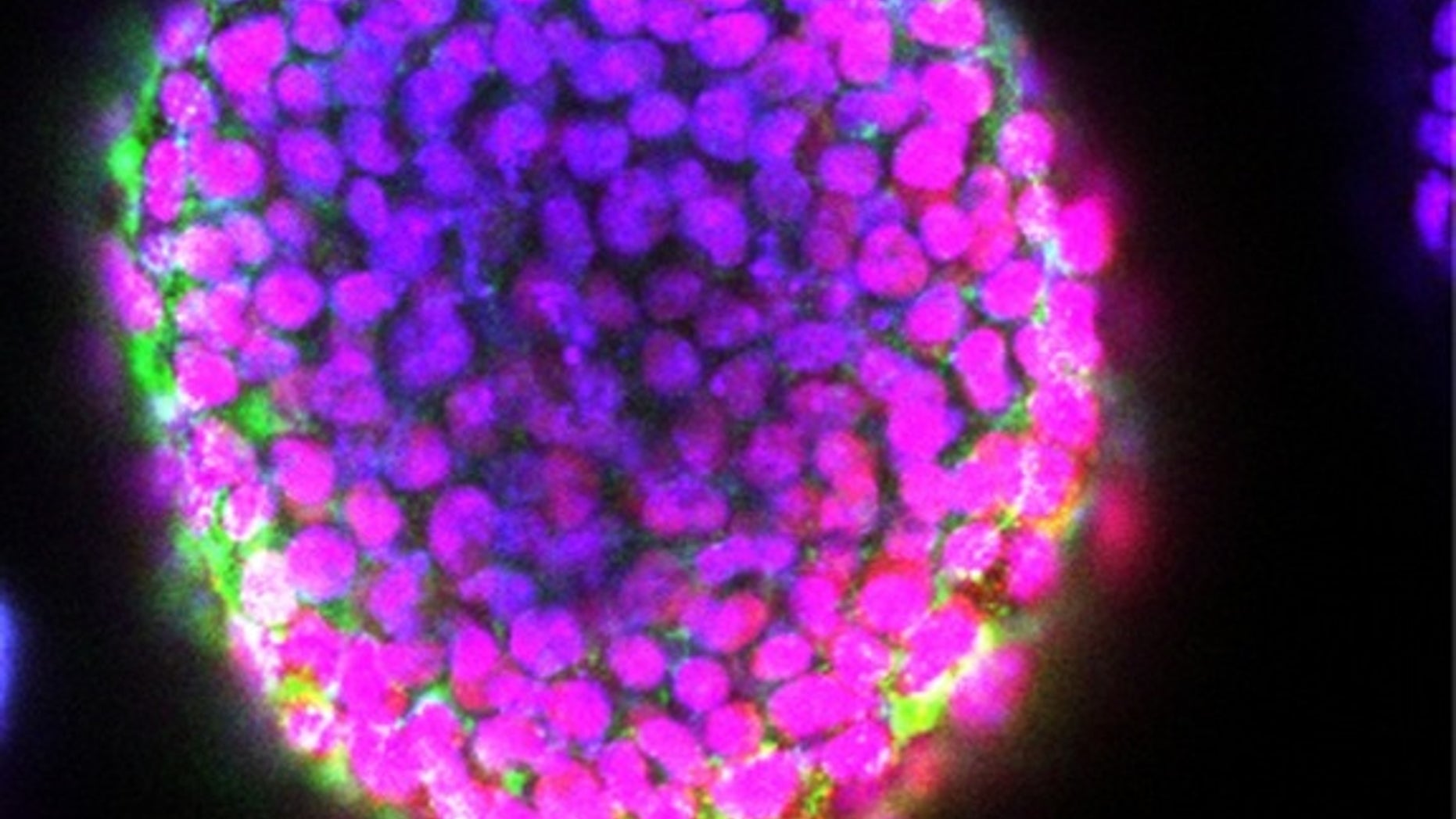 Researchers have figured out a way to print 3D blocks of living stem cells.