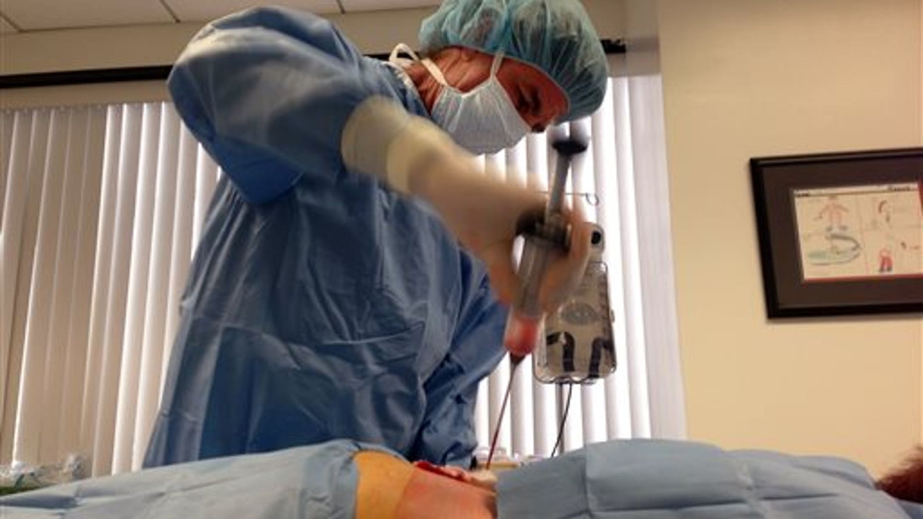 In this Dec. 5, 2014 photo, Dr. Mark Berman, of the Cell Surgical Network, collects fat from a patients back as the part of an experimental stem cell procedure, in Beverly Hills, Calif. (AP Photo/Raquel Dillion)