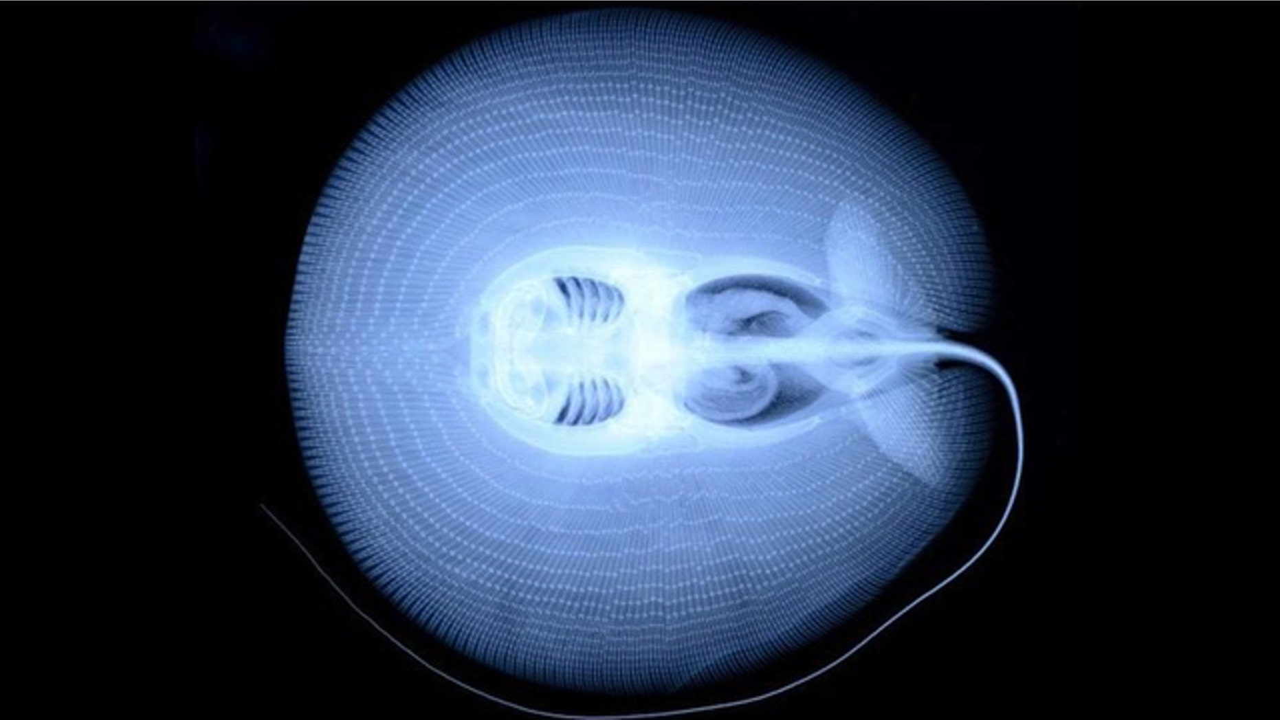A new speices of stingray, X-rayed