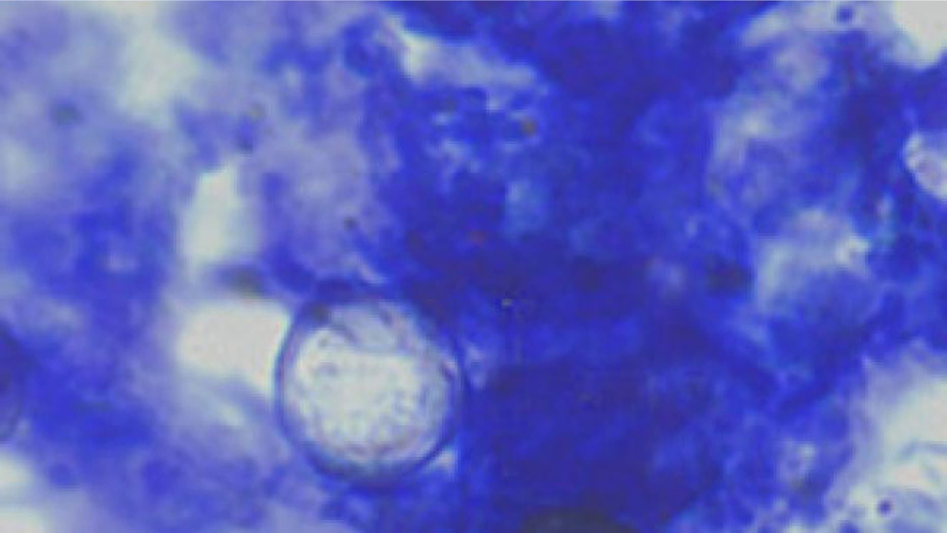 Oocysts of Cyclospora cayetanensis stained with modified acid-fast stain.