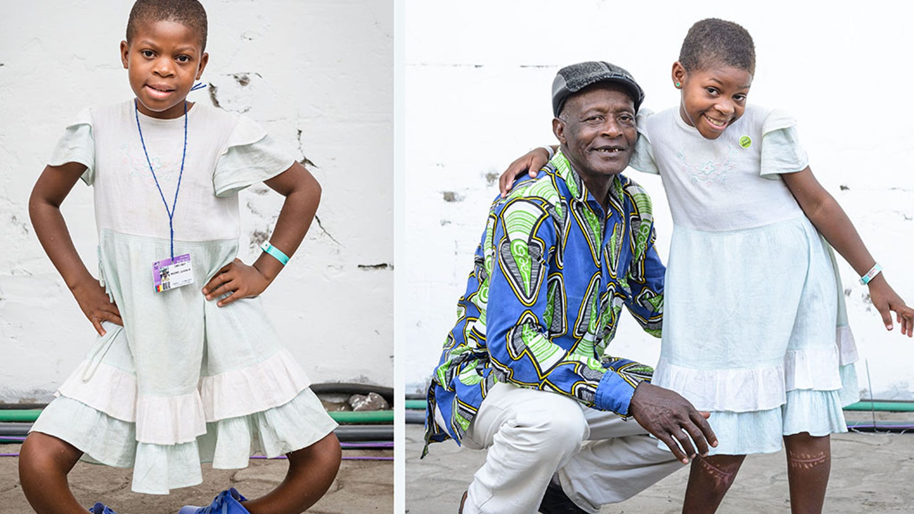 BEFORE/AFTER: 11-year-old Justine before her surgery to correct her severely bowed legs. The girl from Cameroon pictured with her grandfather after the transformative procedure.