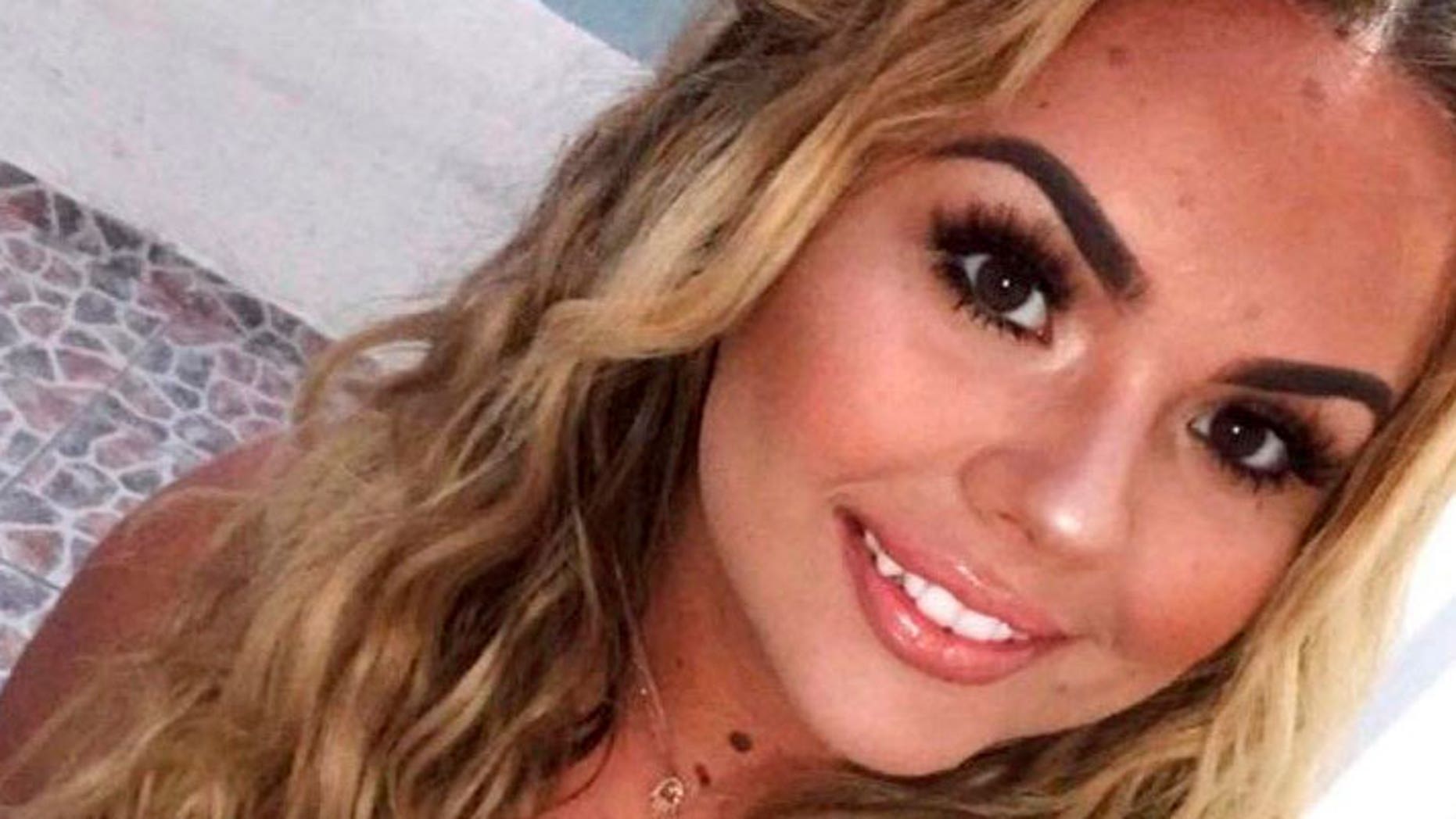 Lydia McDonnell reportedly suffered severe burns to her throat, lungs and arm in the fire.