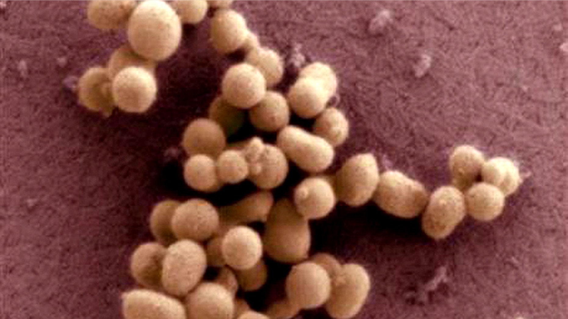 A scanning electron micrograph image of the synthetic bacteria of M. mycoides JCVI-syn1.