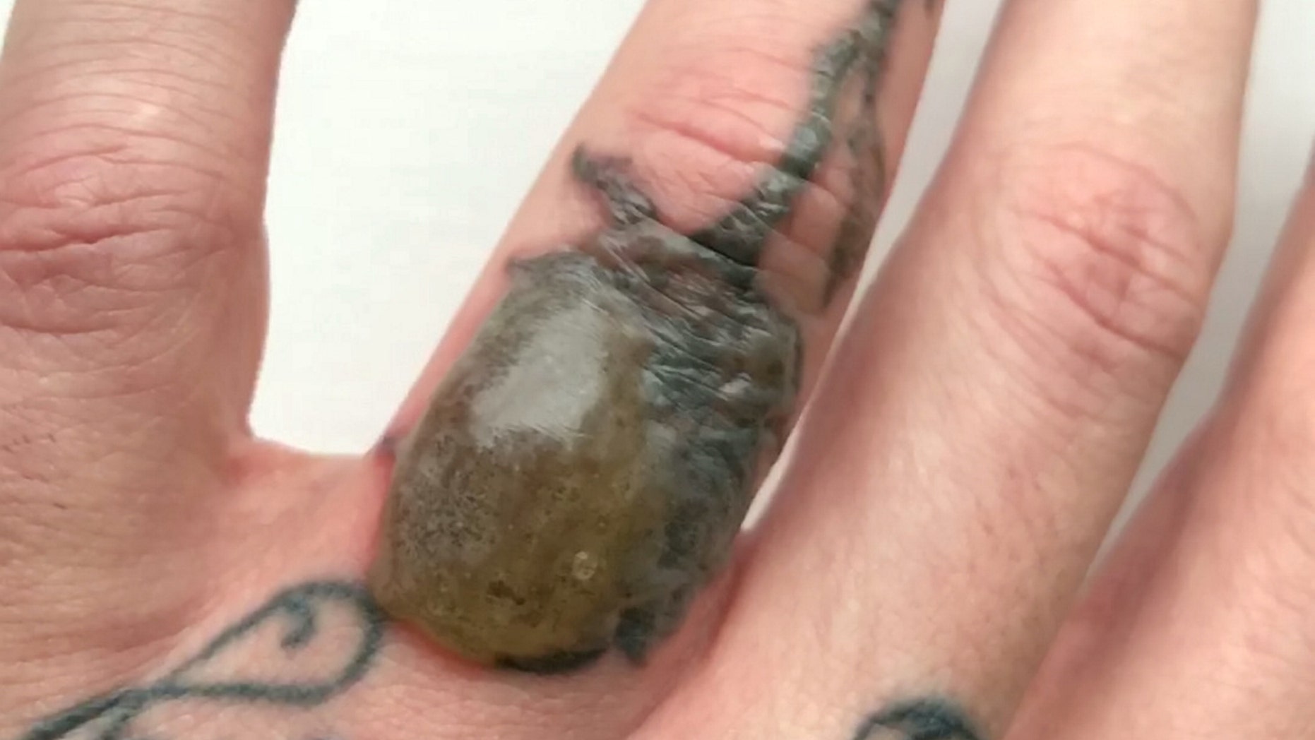Man Develops Blister On Finger During Tattoo Removal Procedure Fox News 