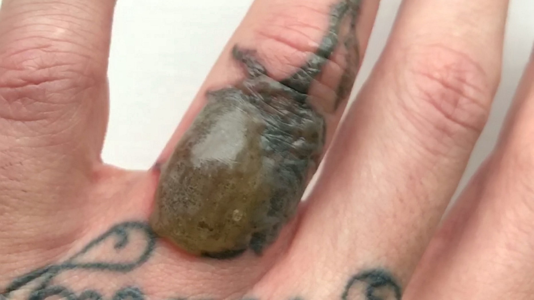 Andrew Milne, 32, wanted his ex-wife's initials removed from the third finger on his left hand.