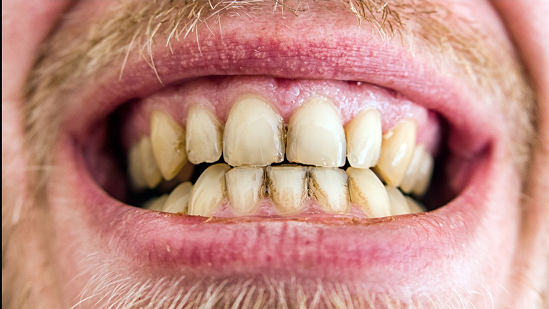 Many of those polled said they would rather face their fears of public speaking than take a seat in the dentist’s chair.
