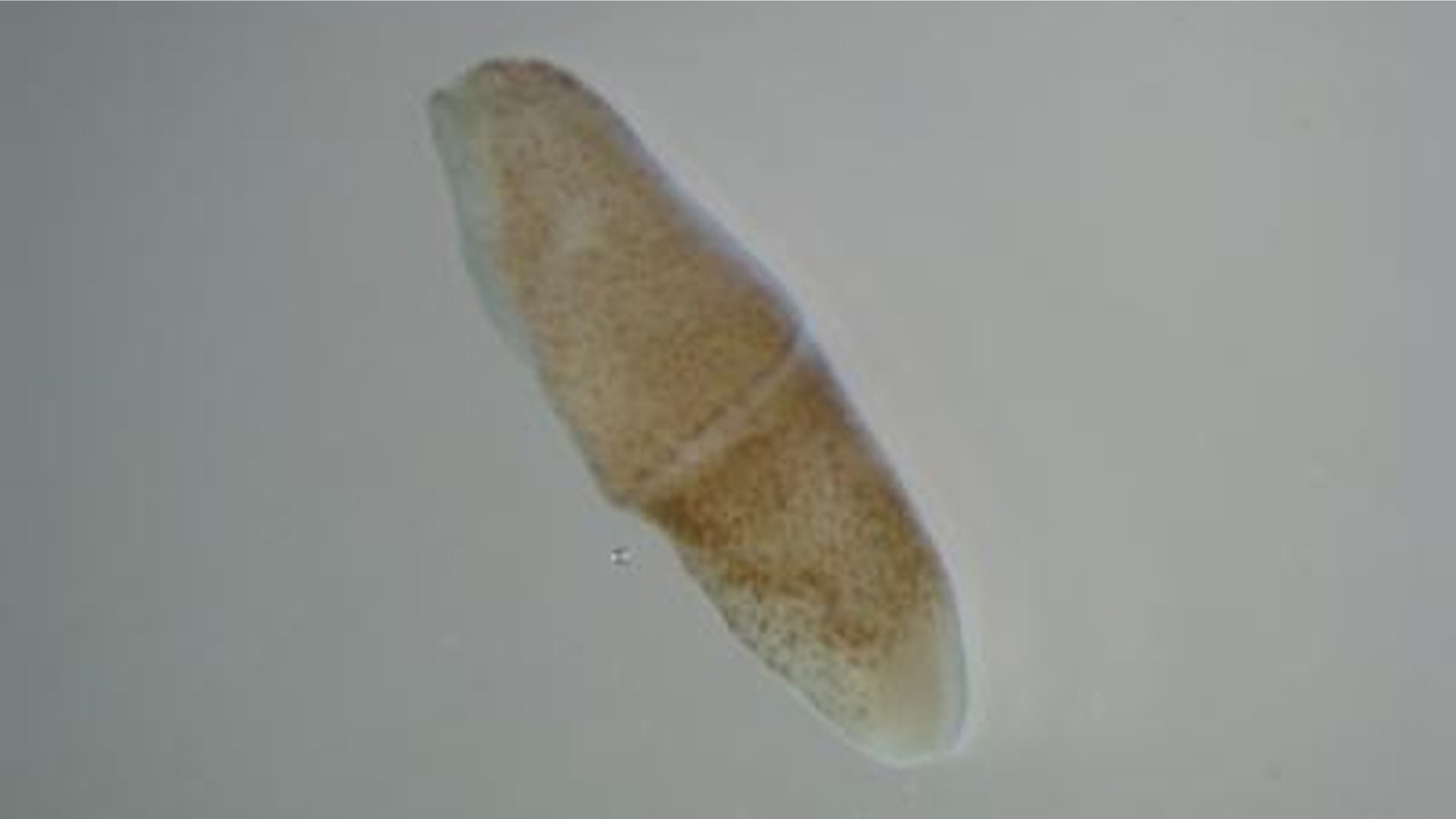 Tiny worms such as these may have giant implications for the entire animal kingdom, scientists say.