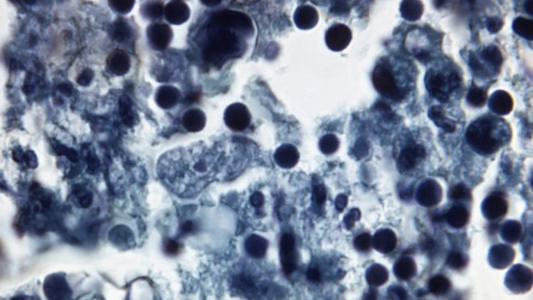 Naegleria fowleri in human brain tissue.